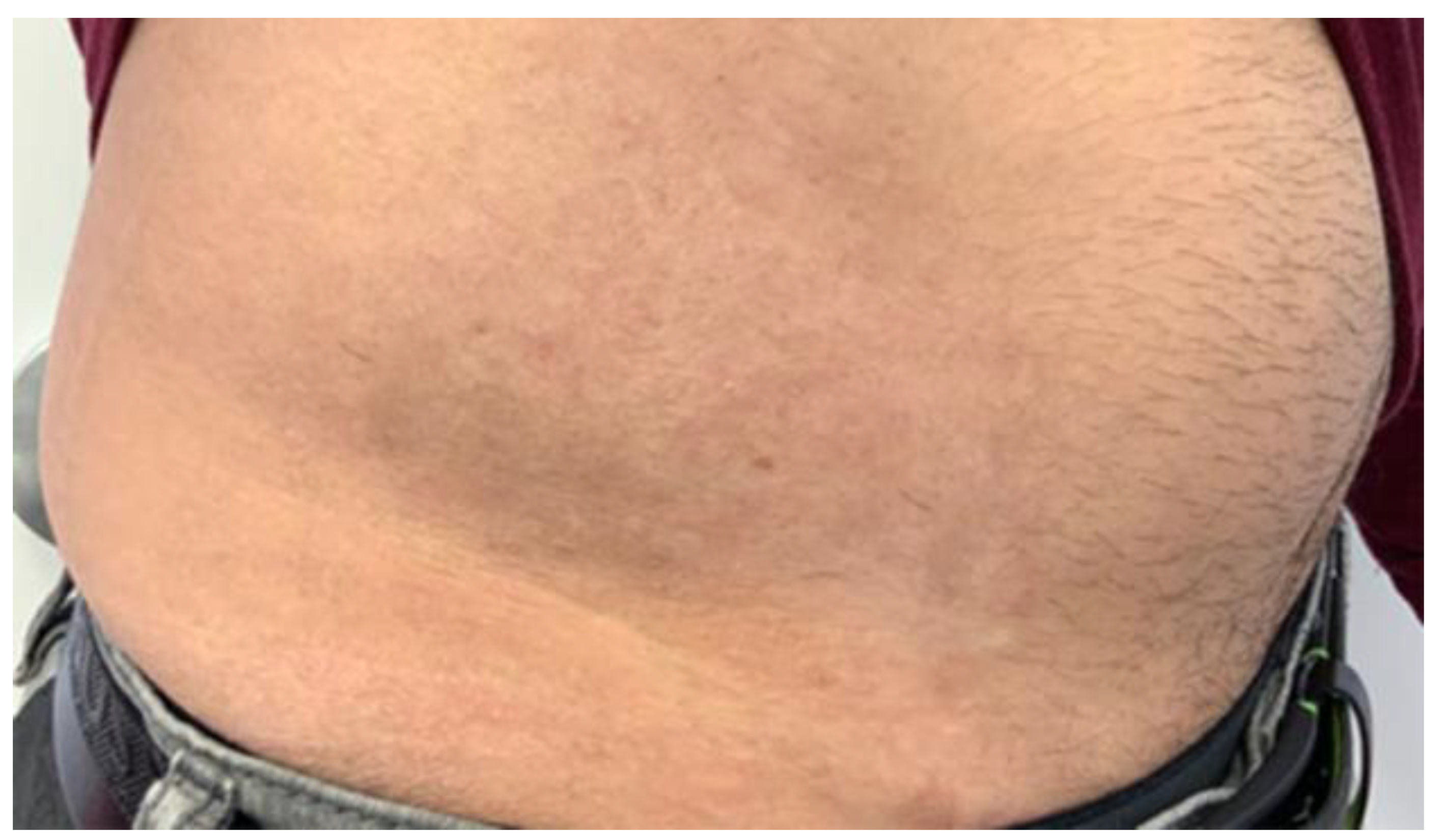 Cosmetics 09 00010 g006 550