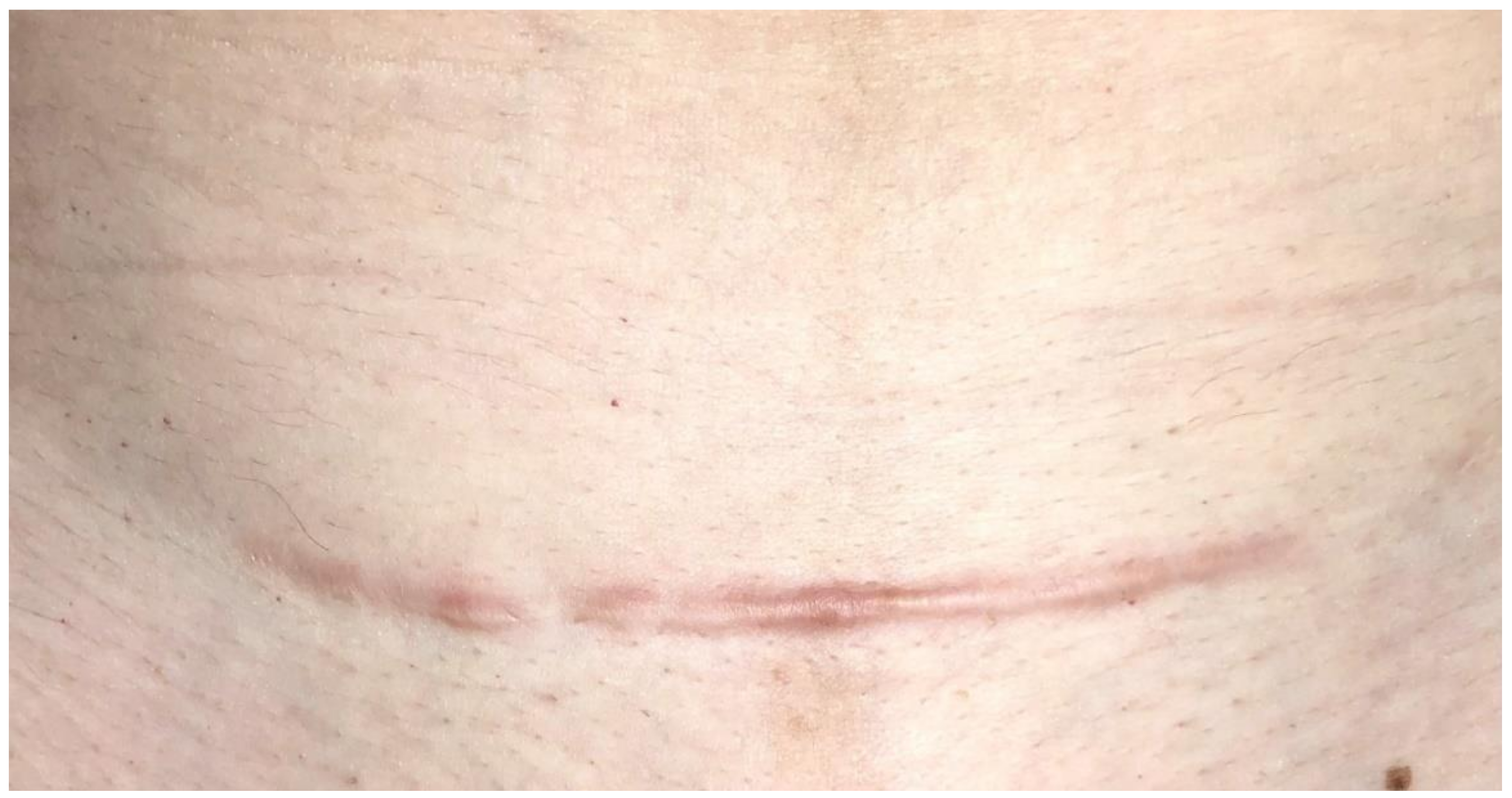 Cosmetics 09 00028 g004 550