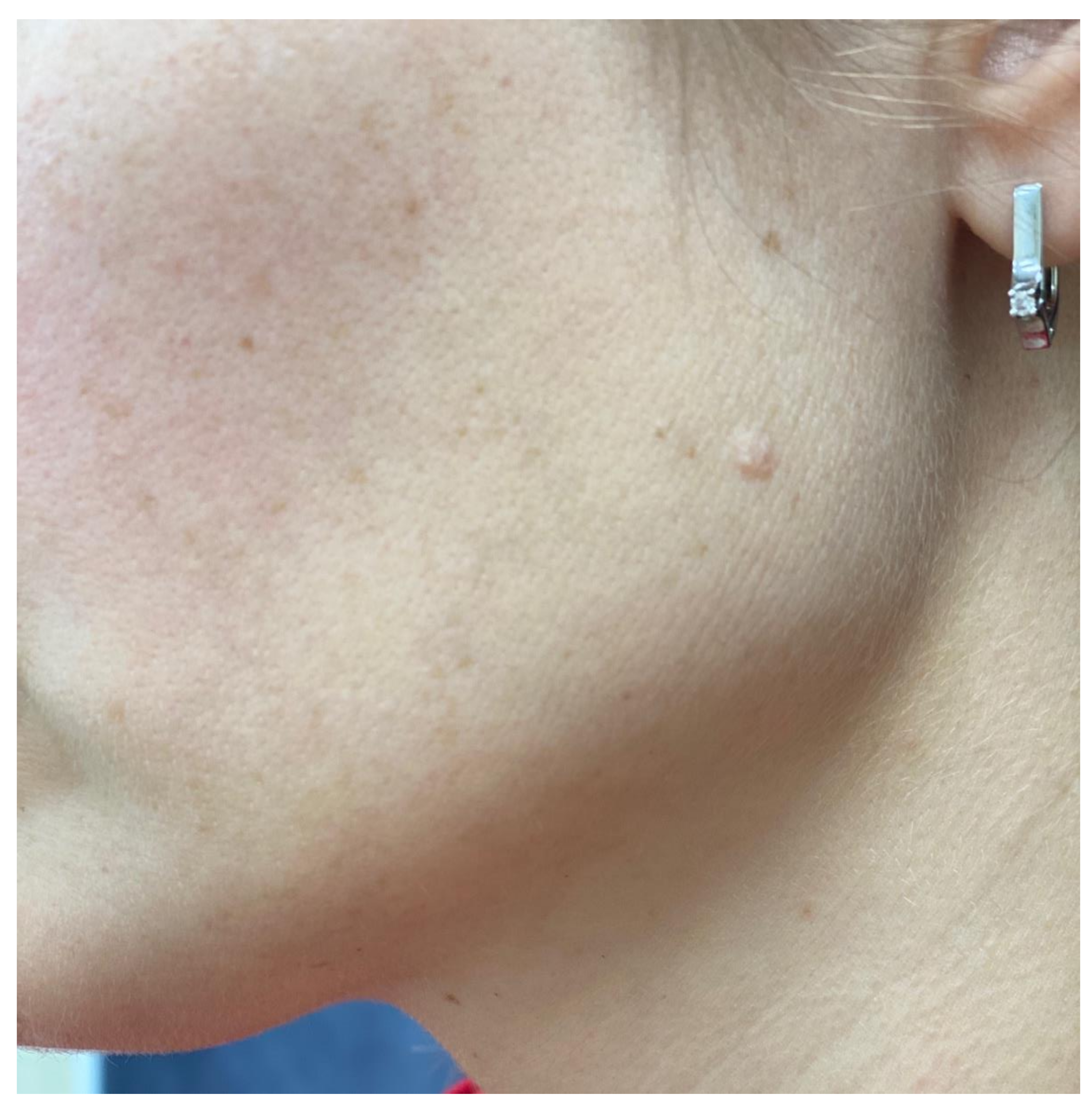 Cosmetics 09 00028 g005 550