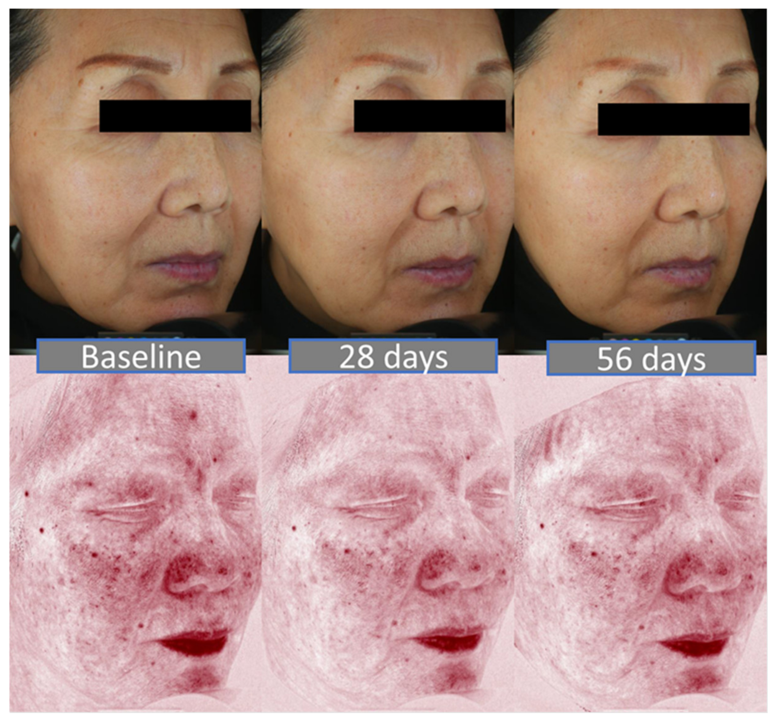 Cosmetics 09 00034 g008 550