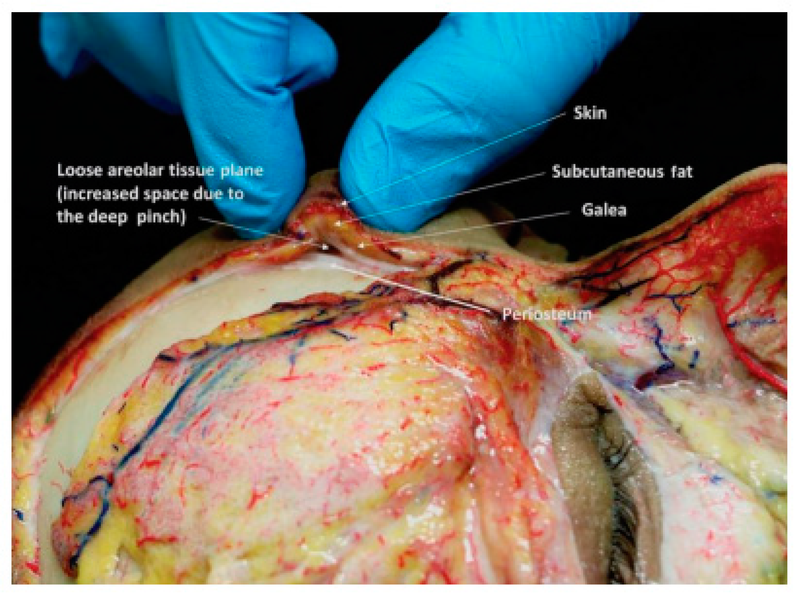 Cosmetics 09 00116 g015 Cosmetics 09 00116 g015