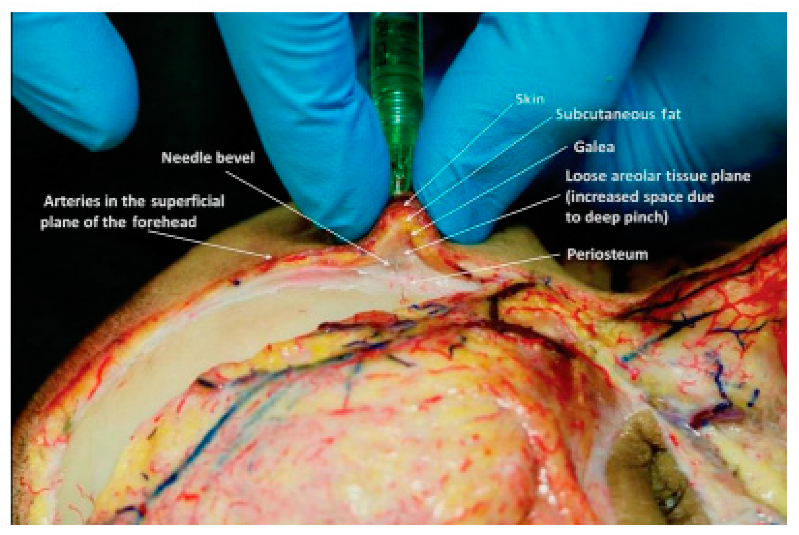 Cosmetics 09 00116 g016 Cosmetics 09 00116 g016