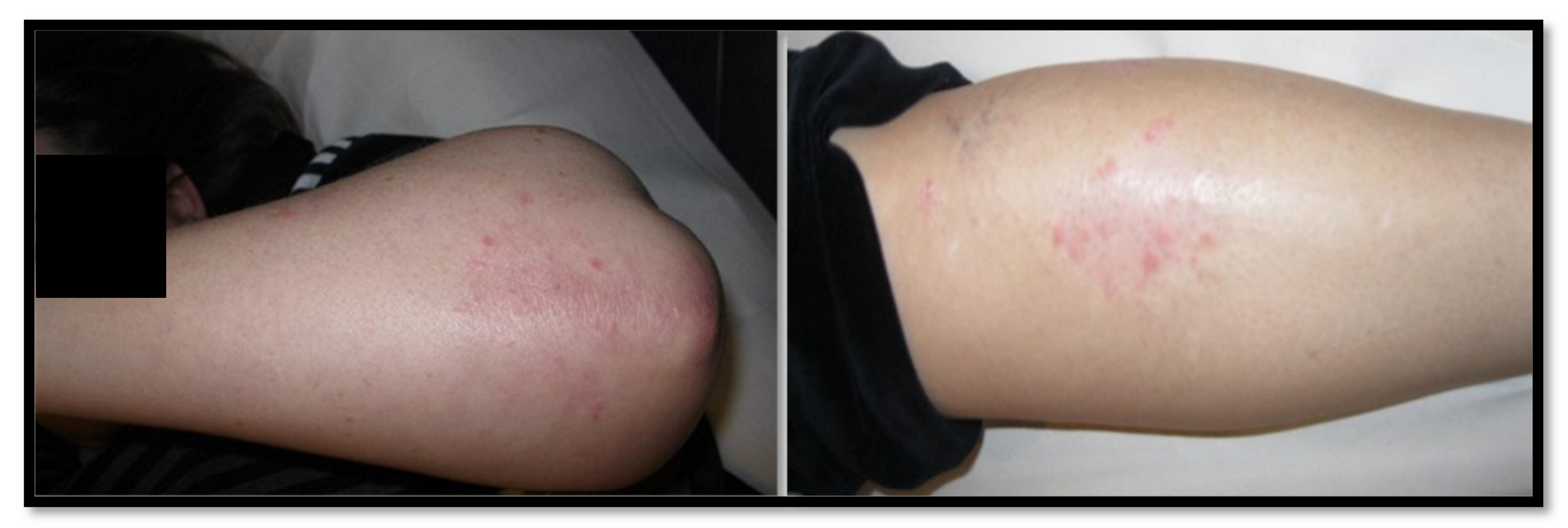 Cosmetics 09 00137 g003 Cosmetics 09 00137 g003