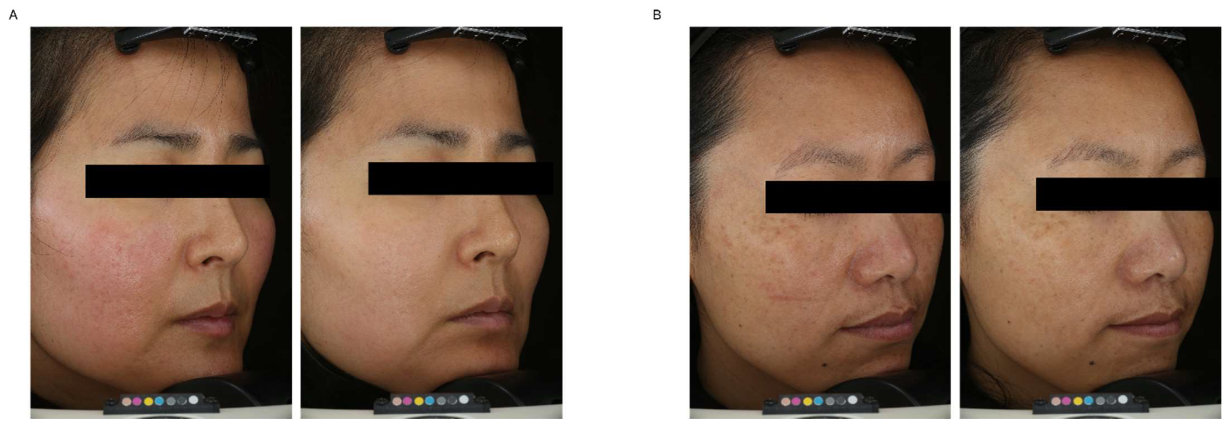 Cosmetics 10 00010 g005