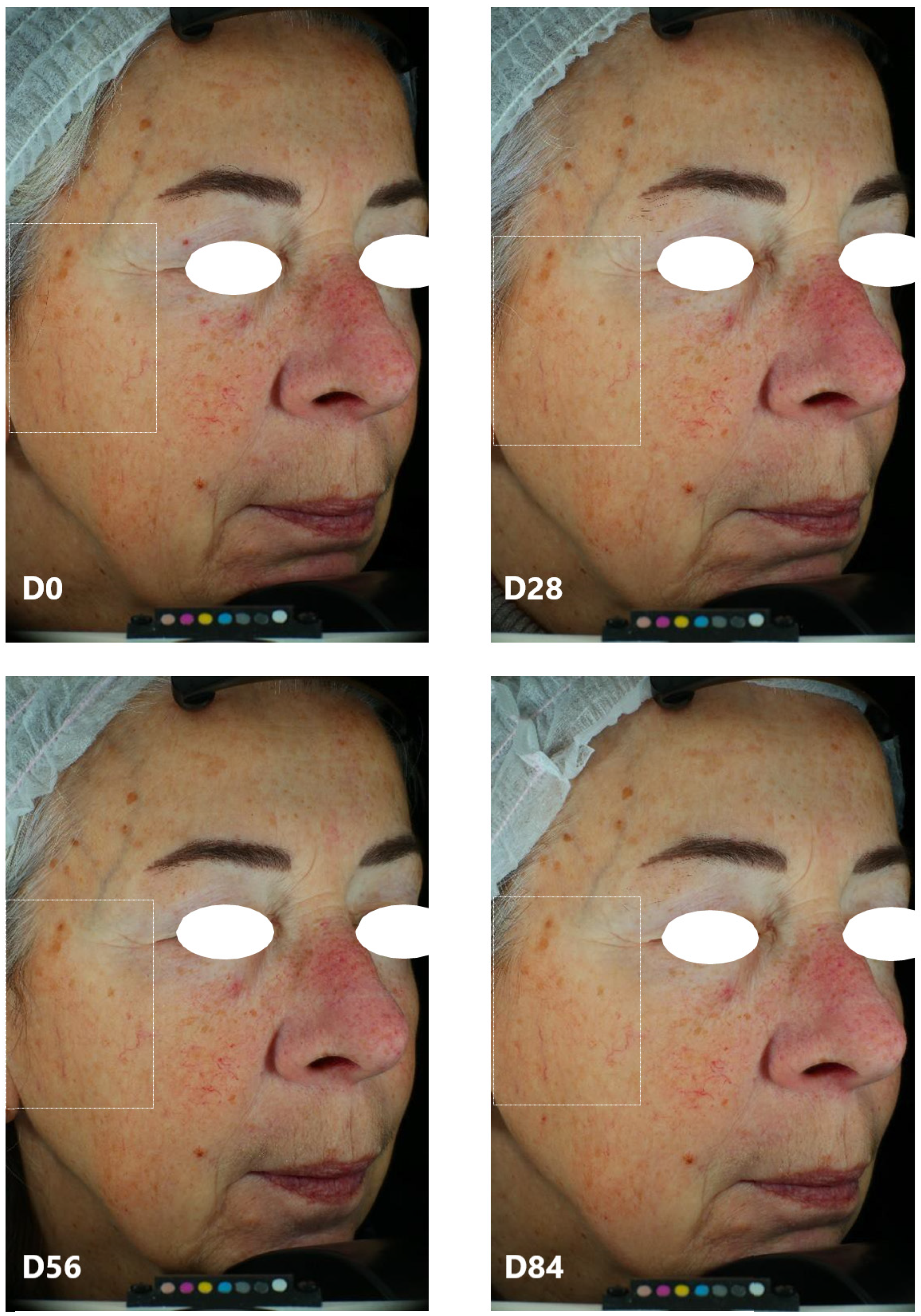 Cosmetics 10 00016 g005