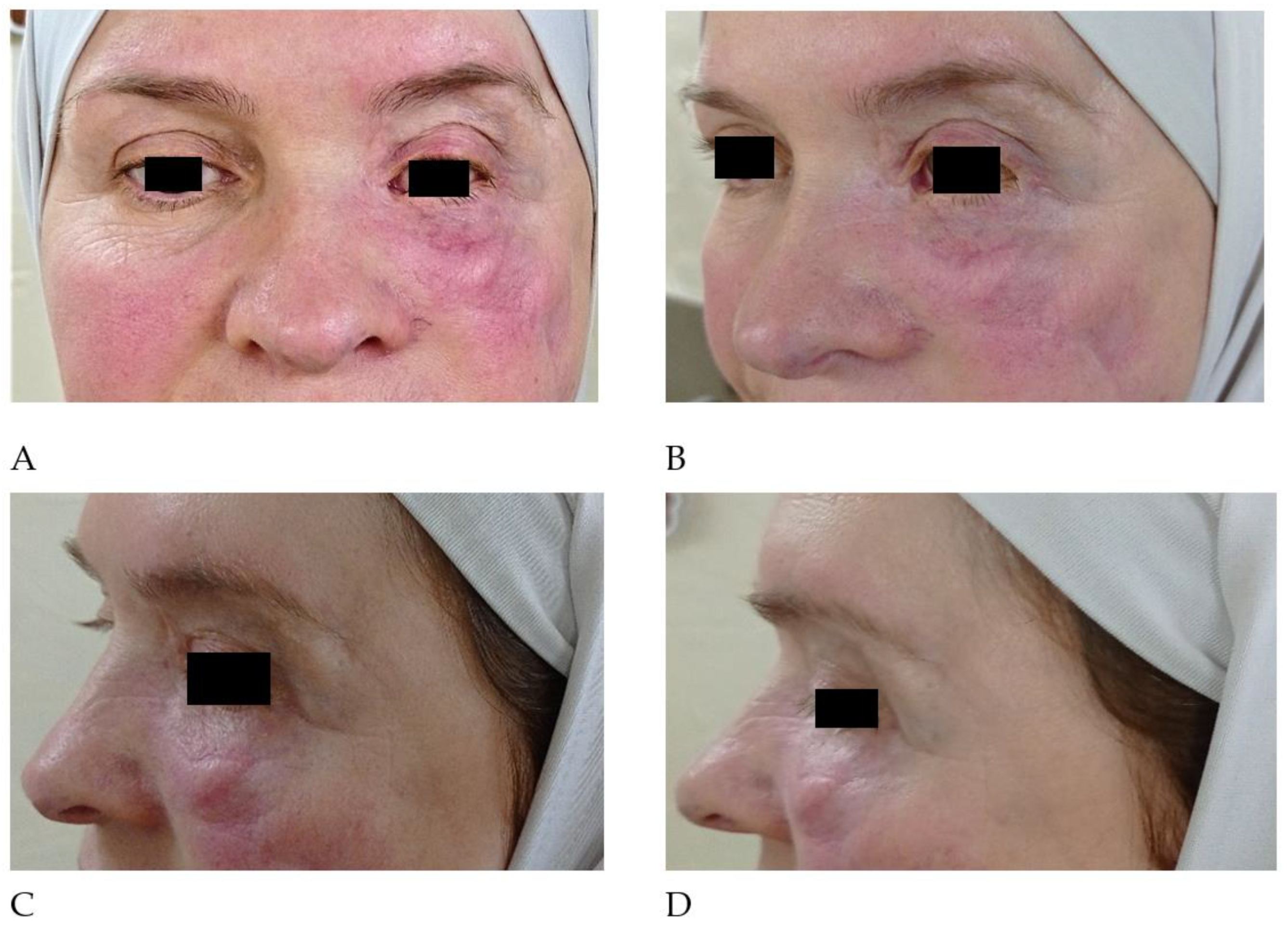 Cosmetics 10 00052 g001 Cosmetics 10 00052 g001