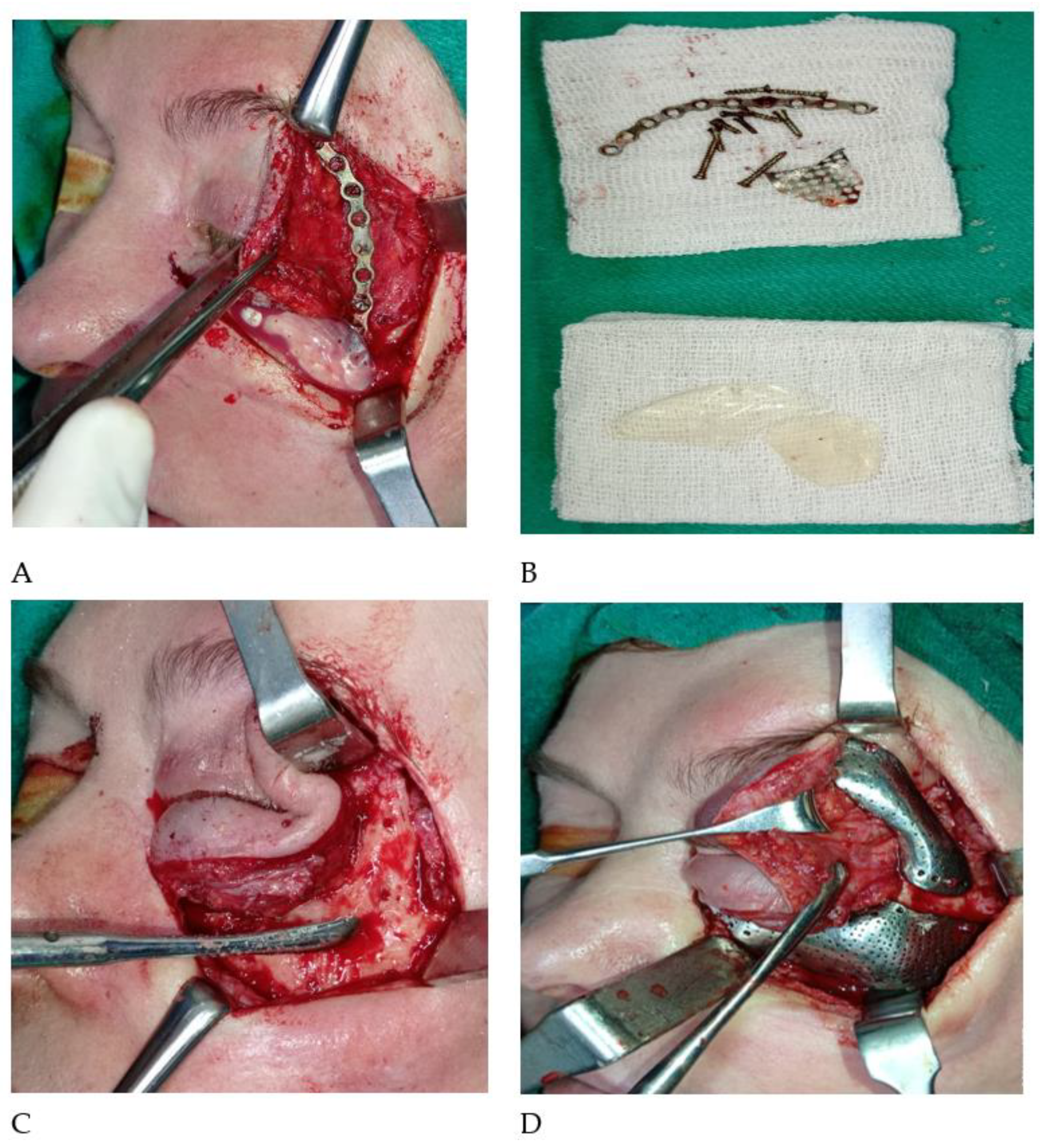 Cosmetics 10 00052 g006 Cosmetics 10 00052 g006