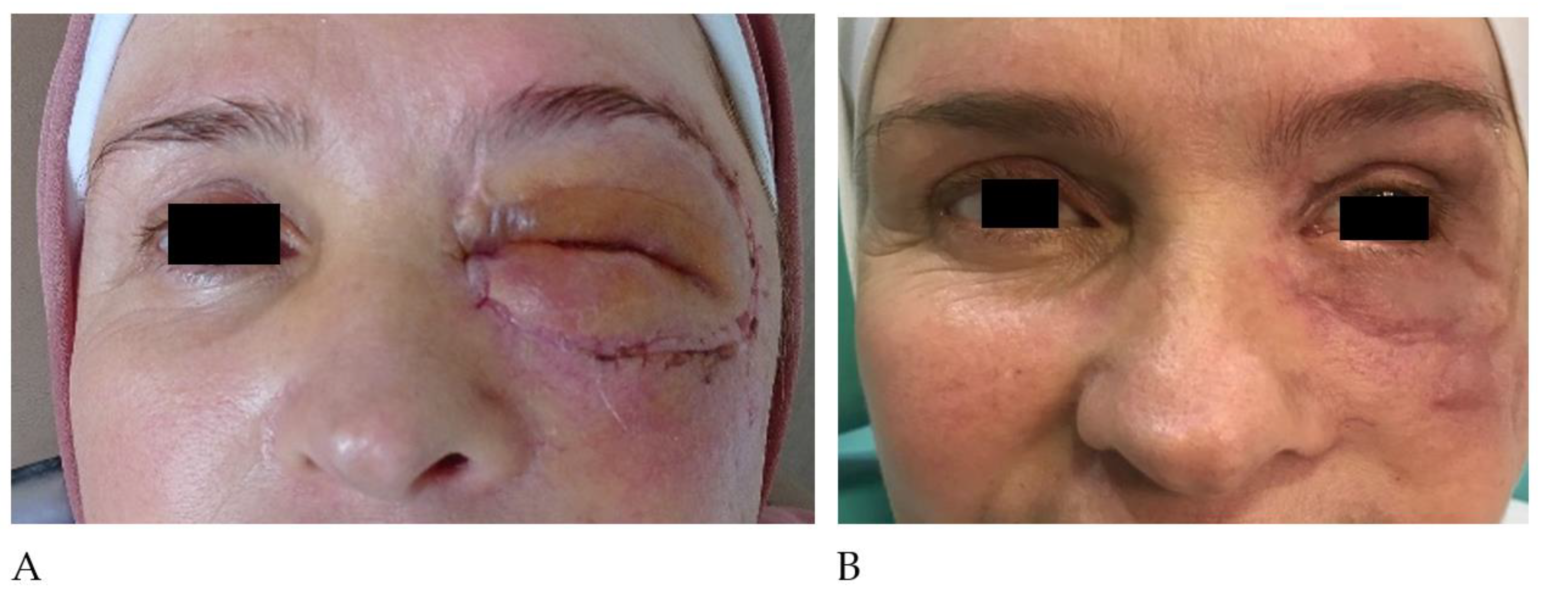 Cosmetics 10 00052 g007 Cosmetics 10 00052 g007