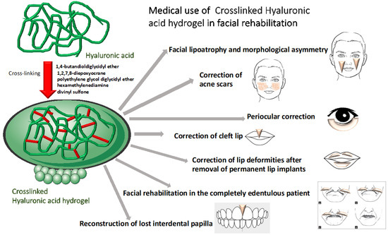 MY  2022 Topps Gallery George Springer #77 Private Issue 120/250