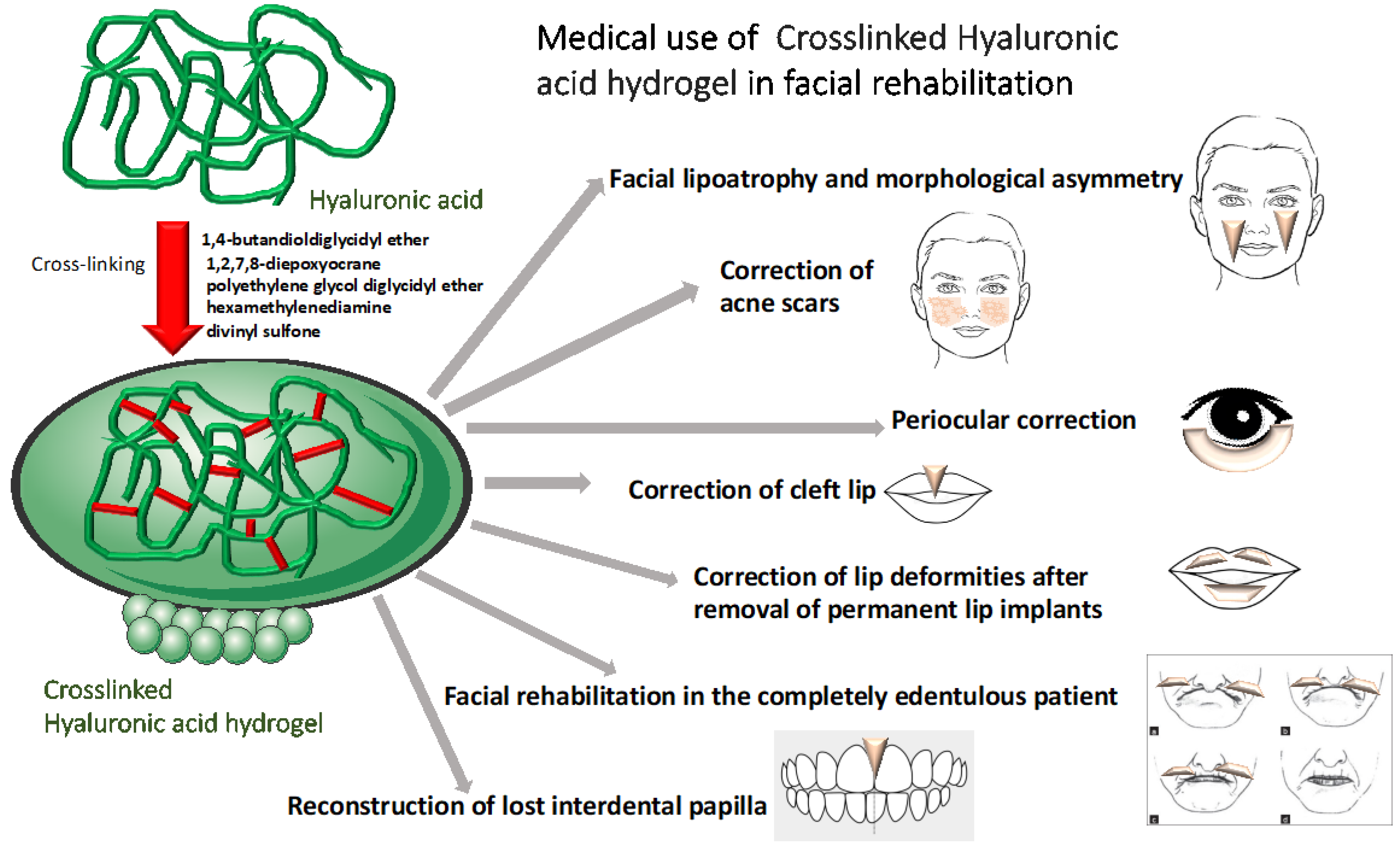Cosmetics | Free Full-Text | Hyaluronic Acid in Facial 
