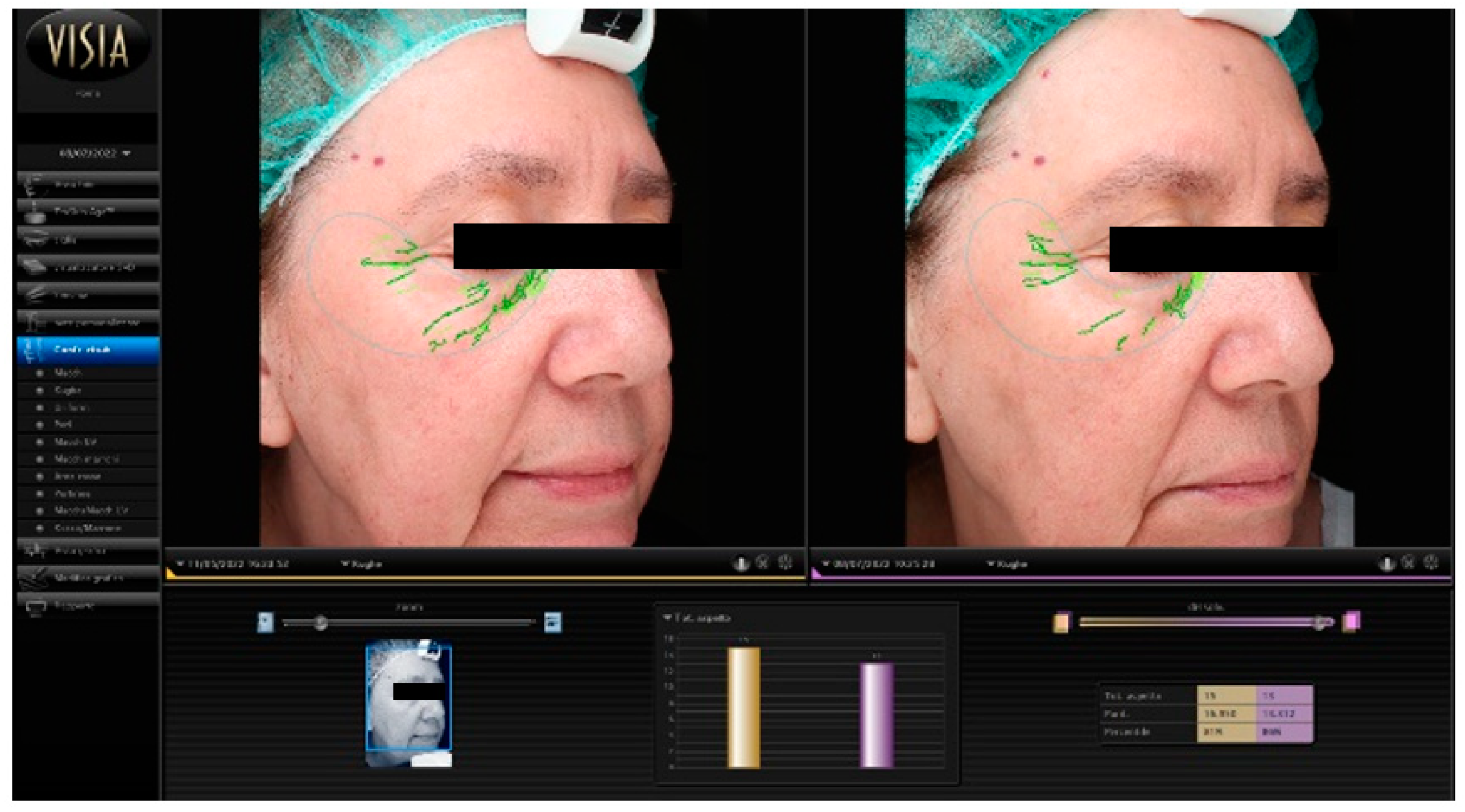 Cosmetics 10 00074 g003