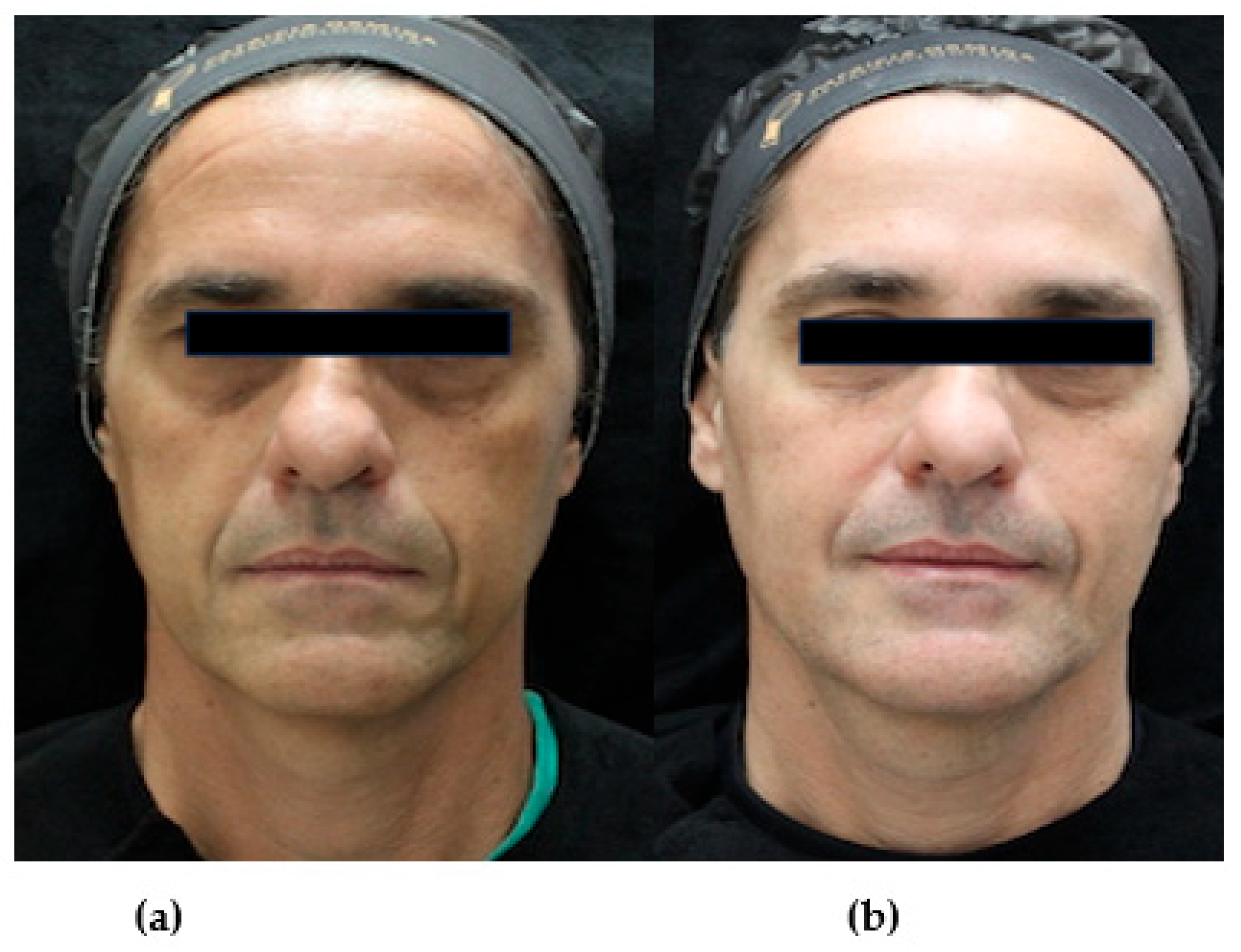 Cosmetics 10 00105 g002