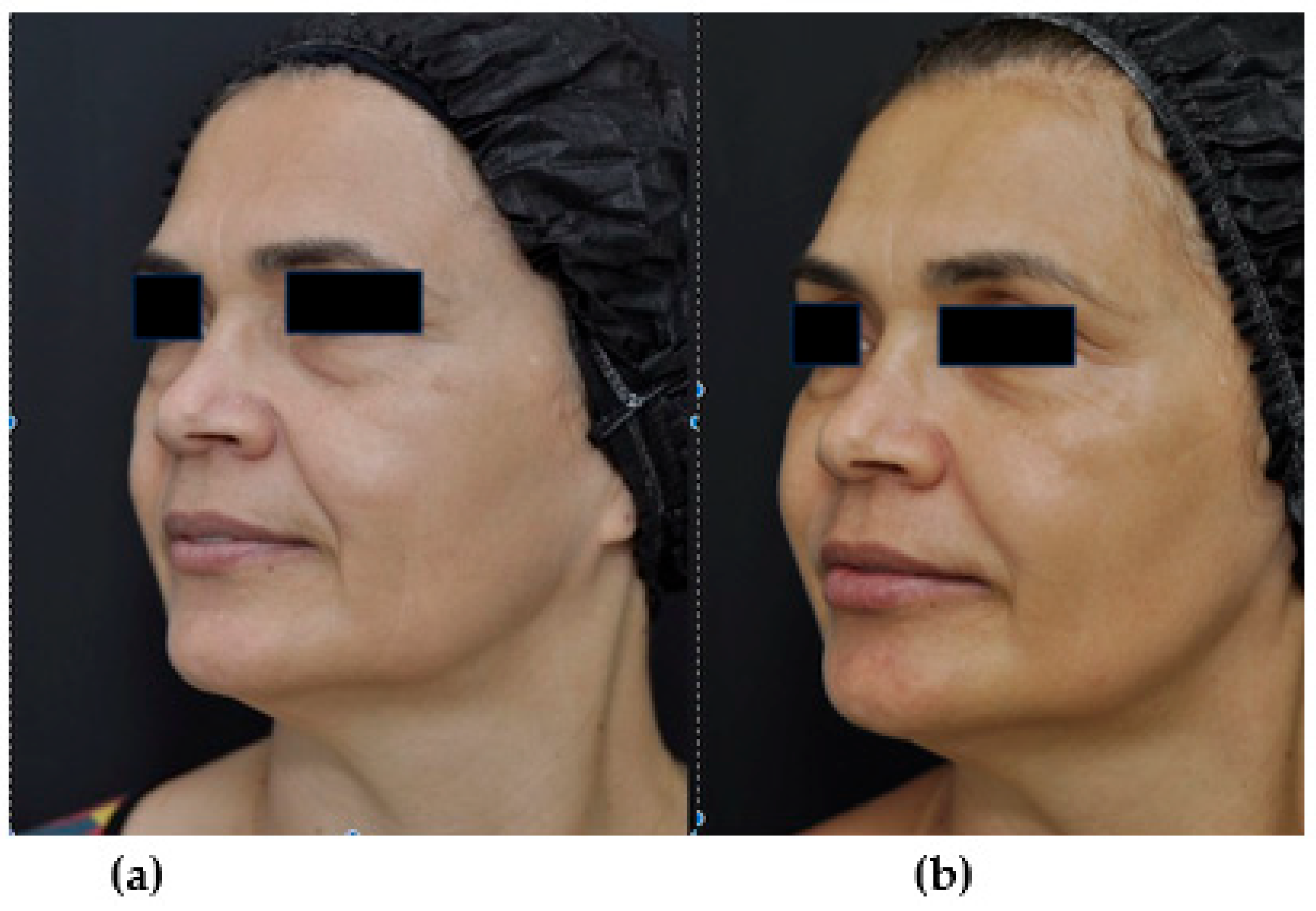 Cosmetics 10 00105 g003