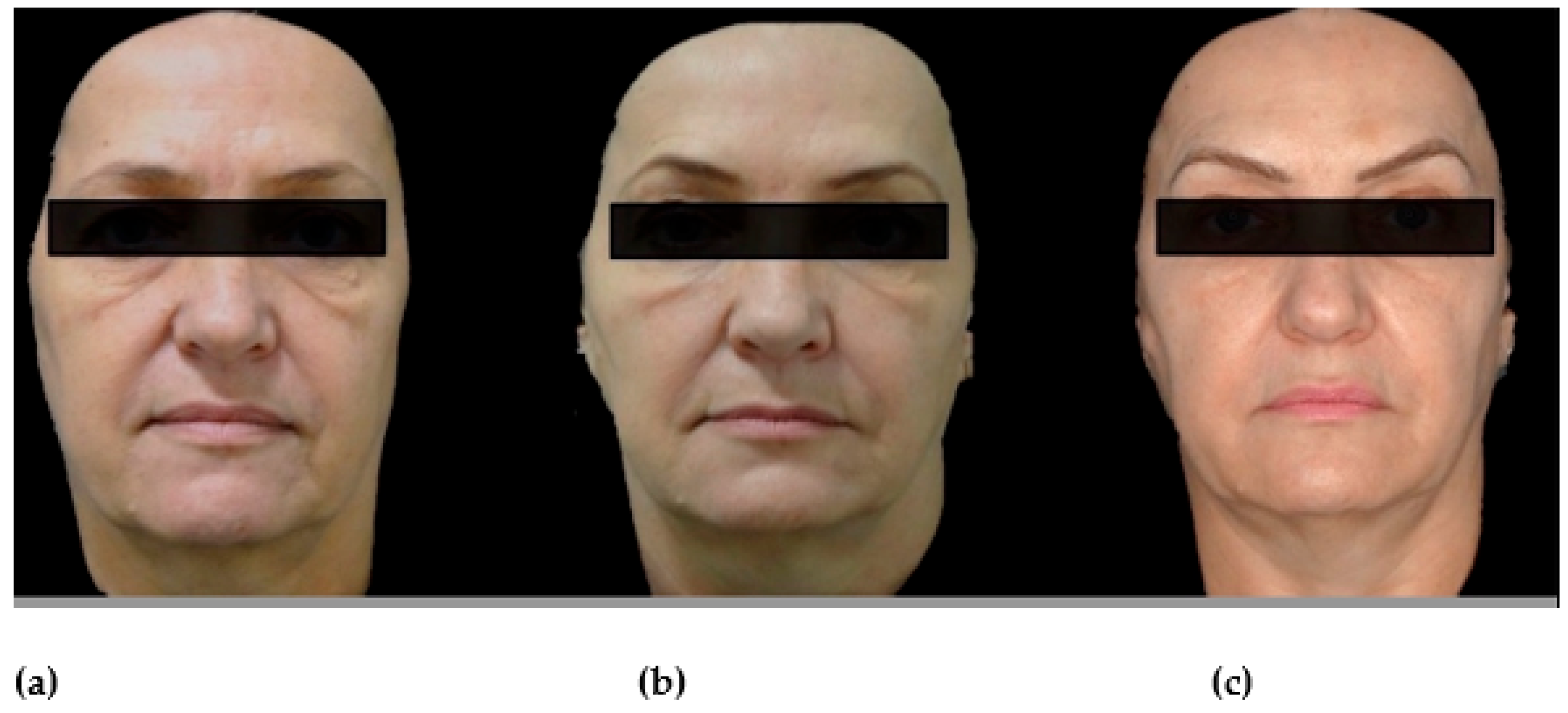 Cosmetics 10 00105 g004