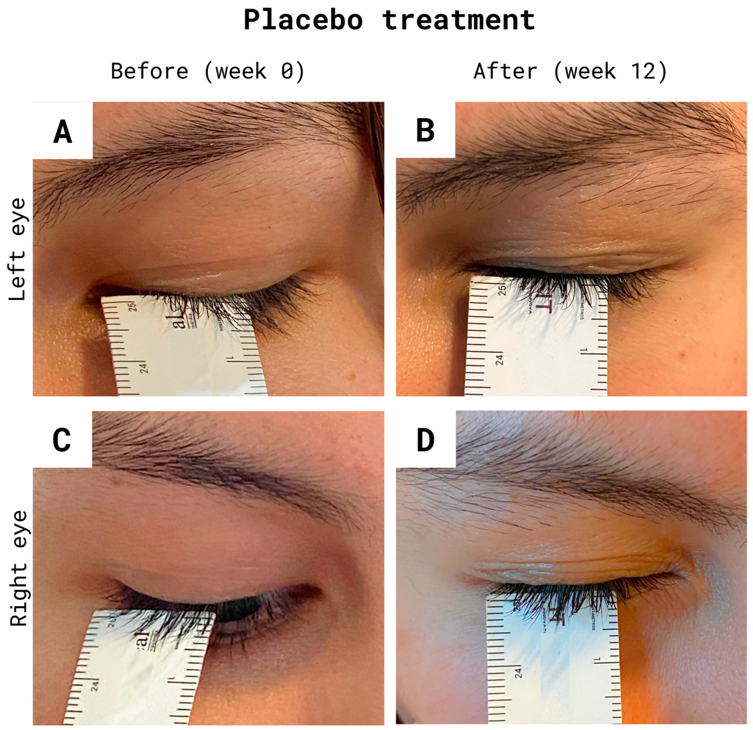 Cosmetics 10 00136 g004 Cosmetics 10 00136 g004