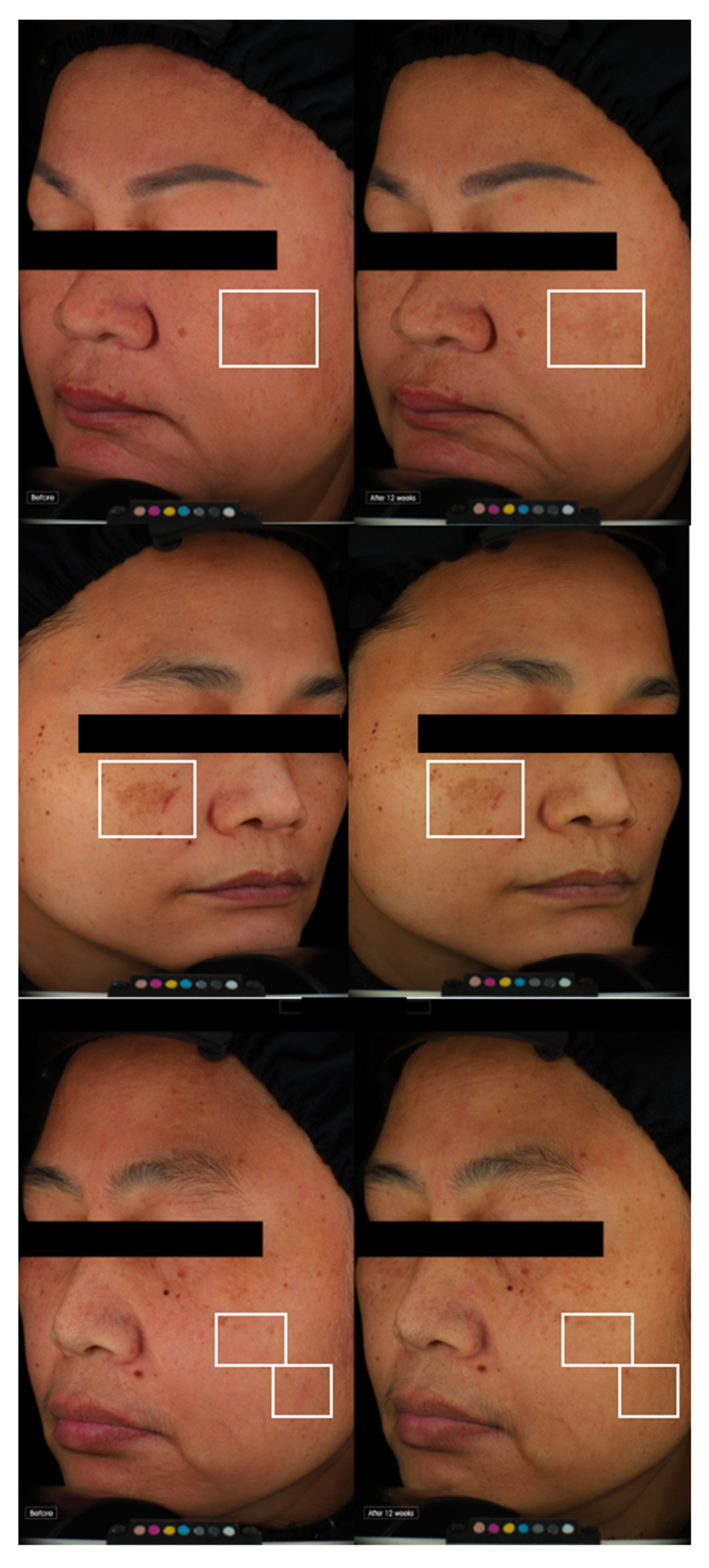 Cosmetics 10 00143 g005