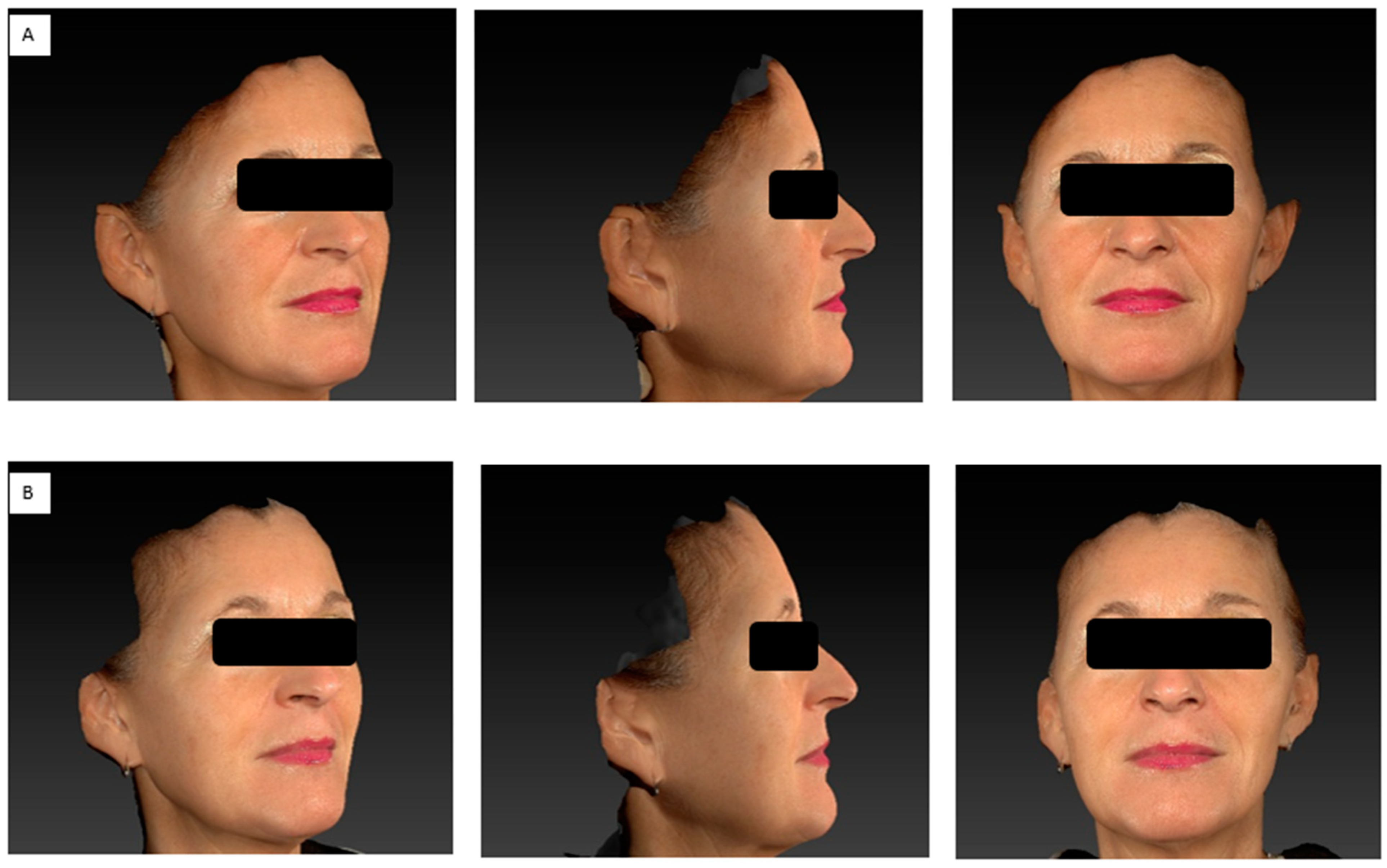 Cosmetics 10 00144 g005