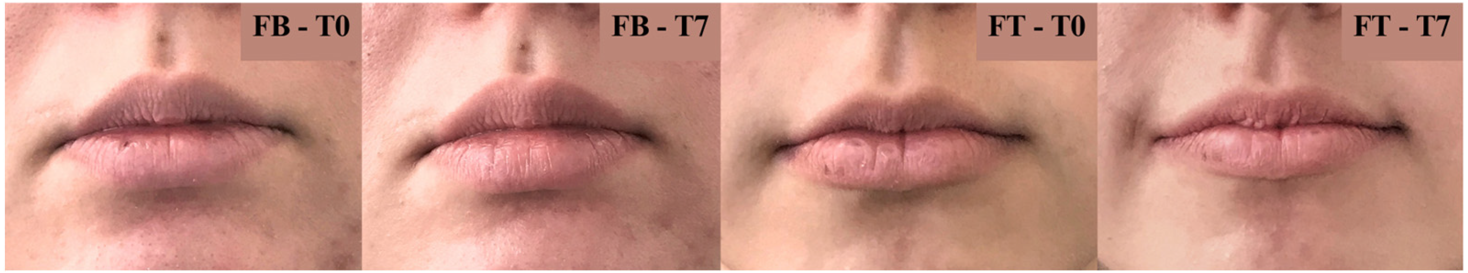 Cosmetics 10 00166 g008