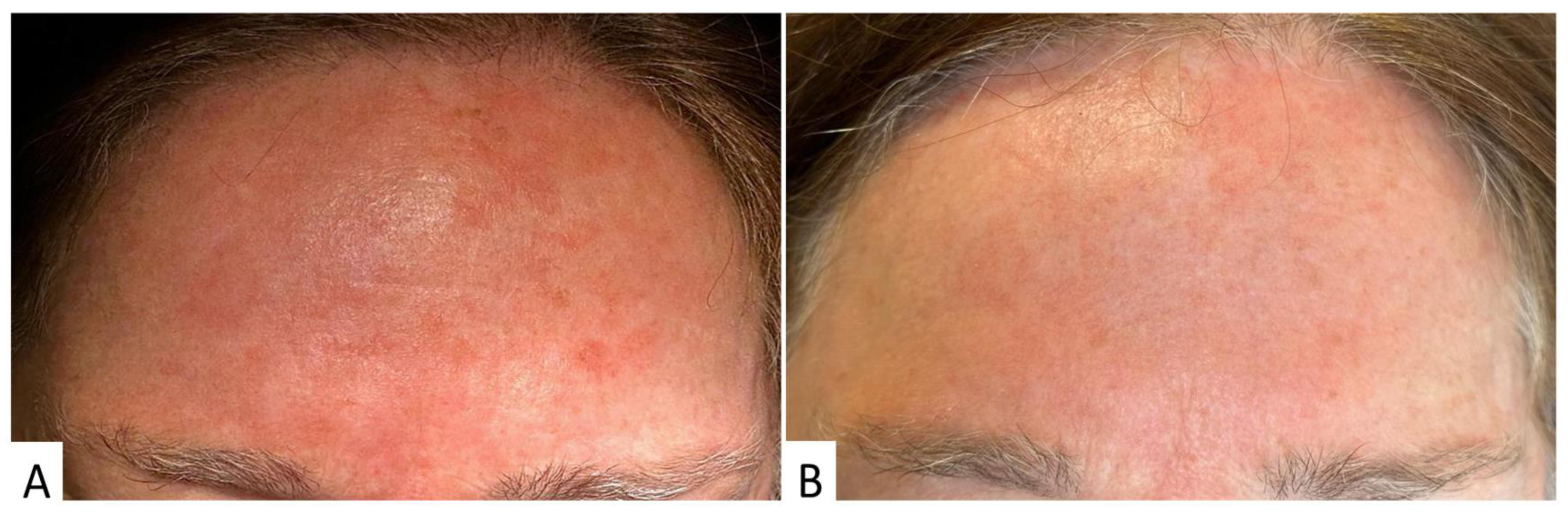 Cosmetics 11 00003 g003