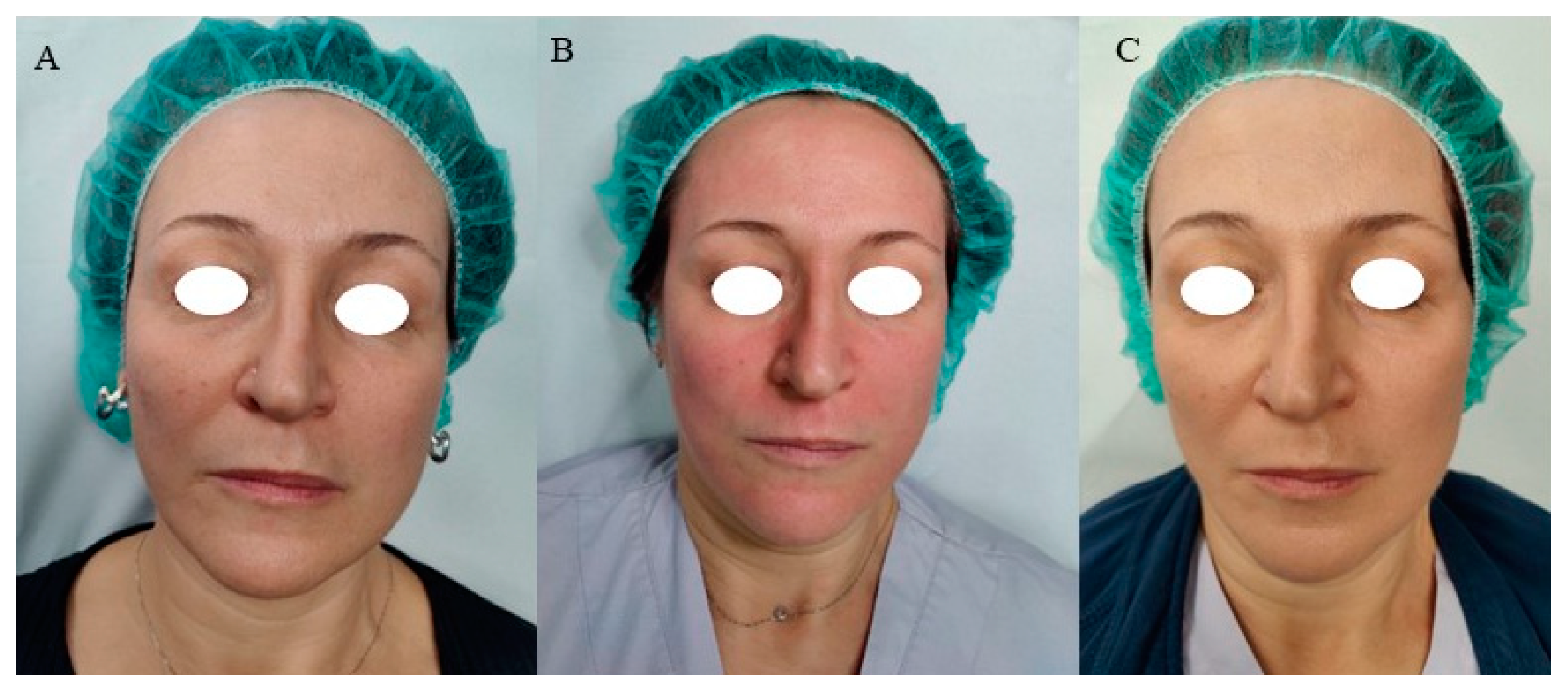 Cosmetics 11 00014 g004