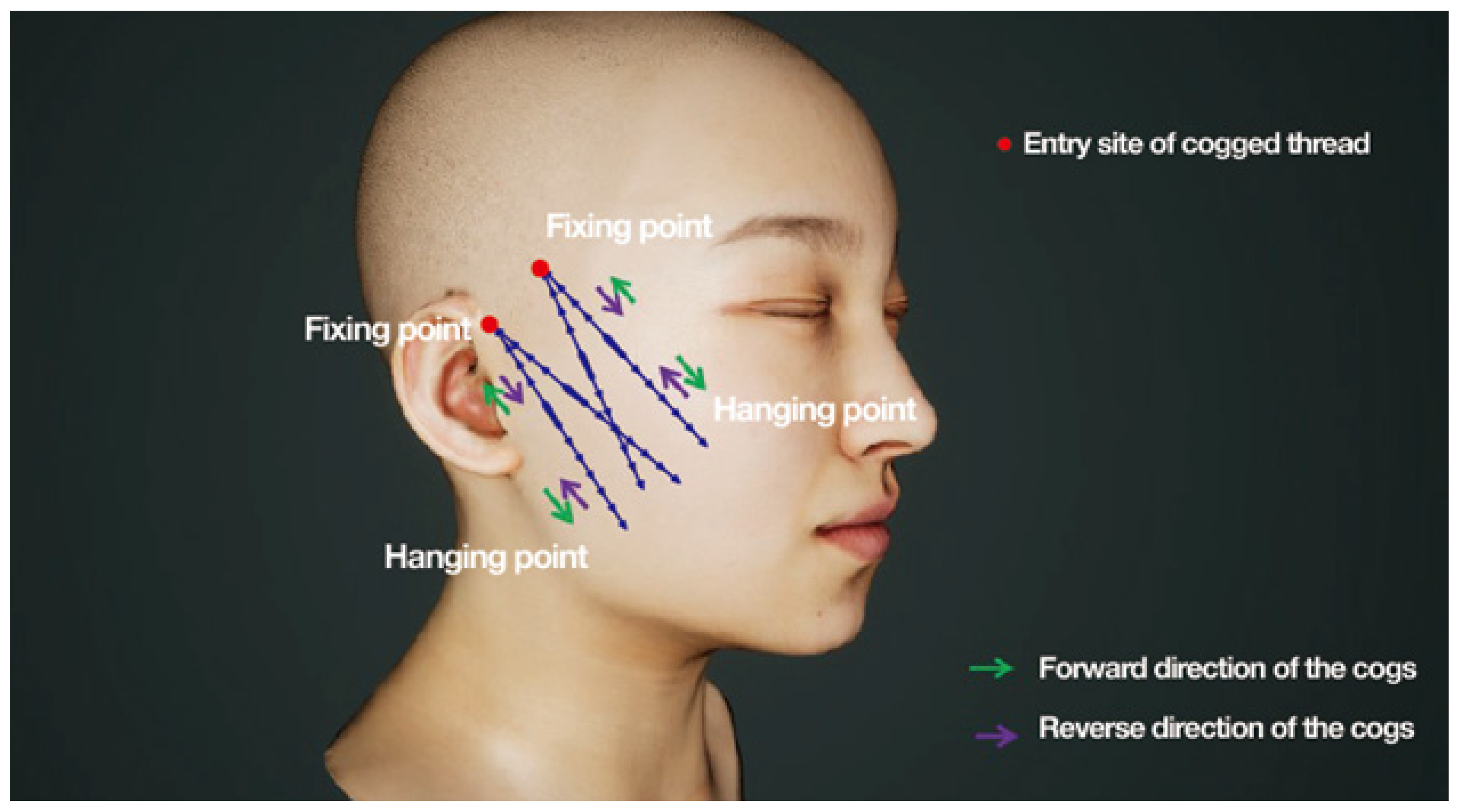 Cosmetics 11 00042 g017