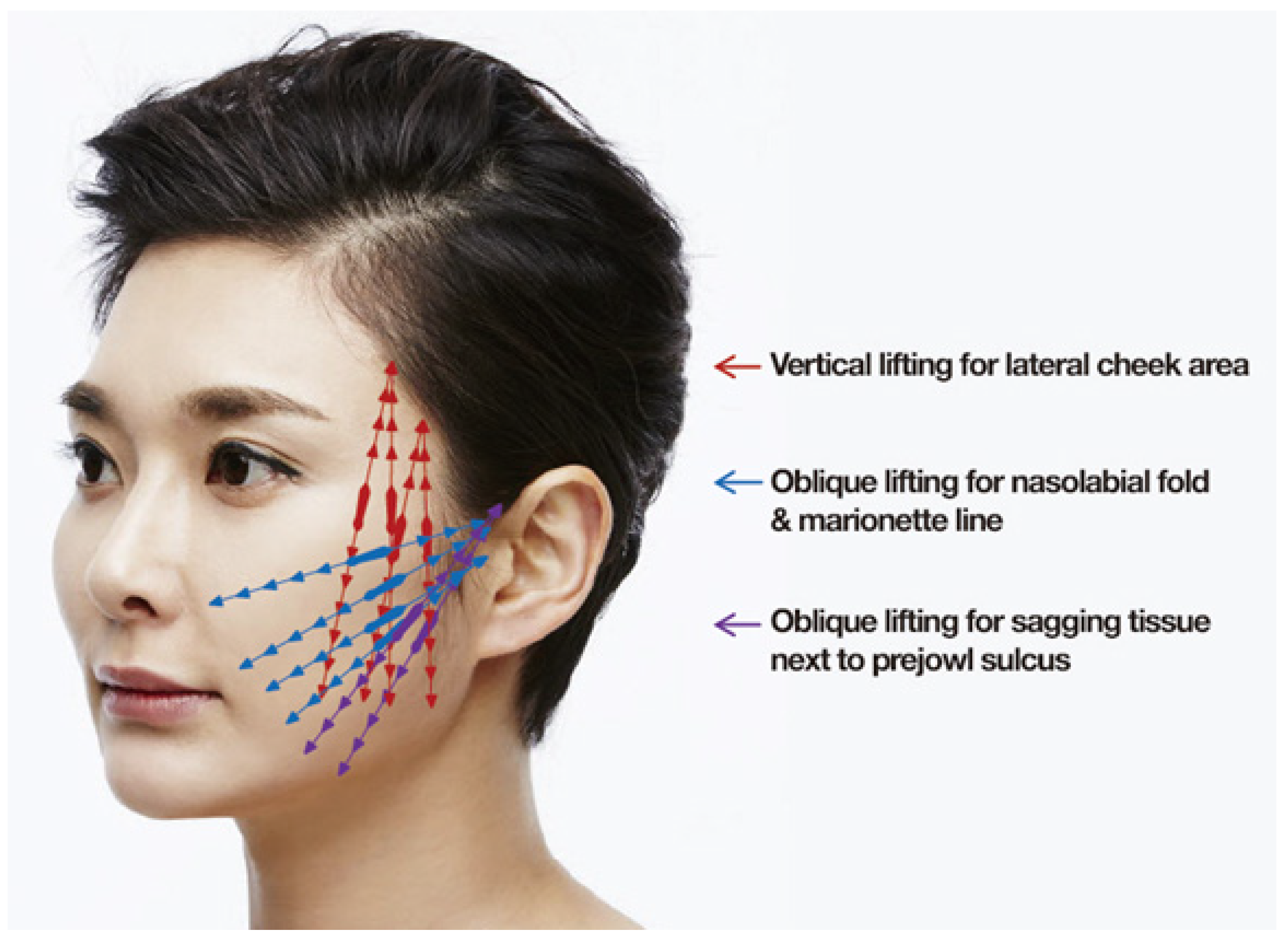 Cosmetics 11 00042 g018