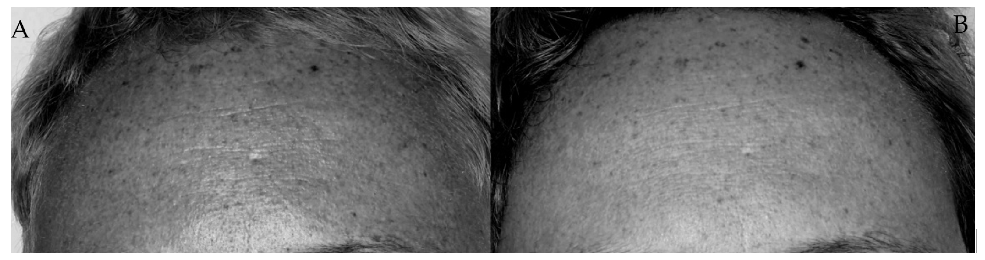 Cosmetics 11 00087 g005