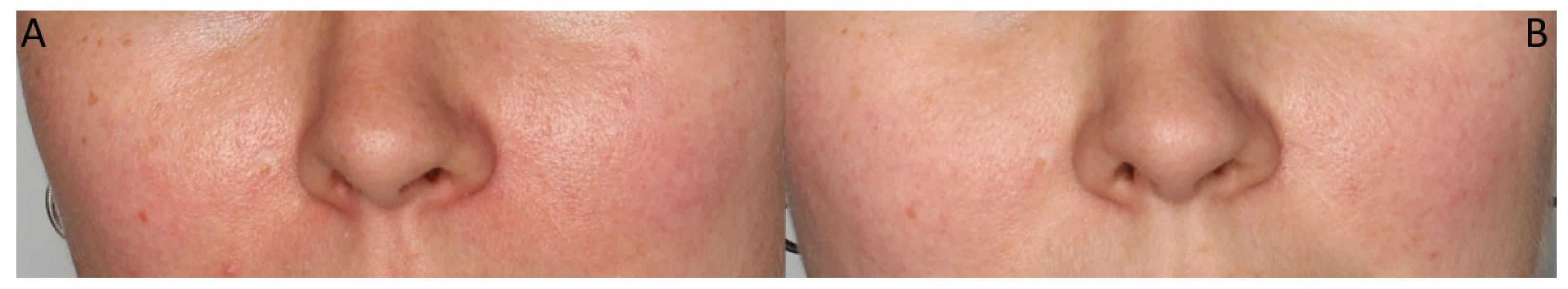 Cosmetics 11 00087 g008