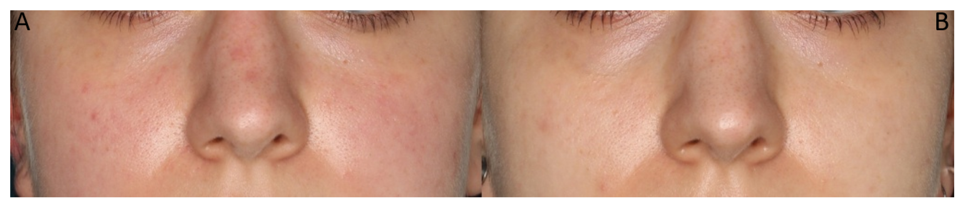 Cosmetics 11 00087 g009