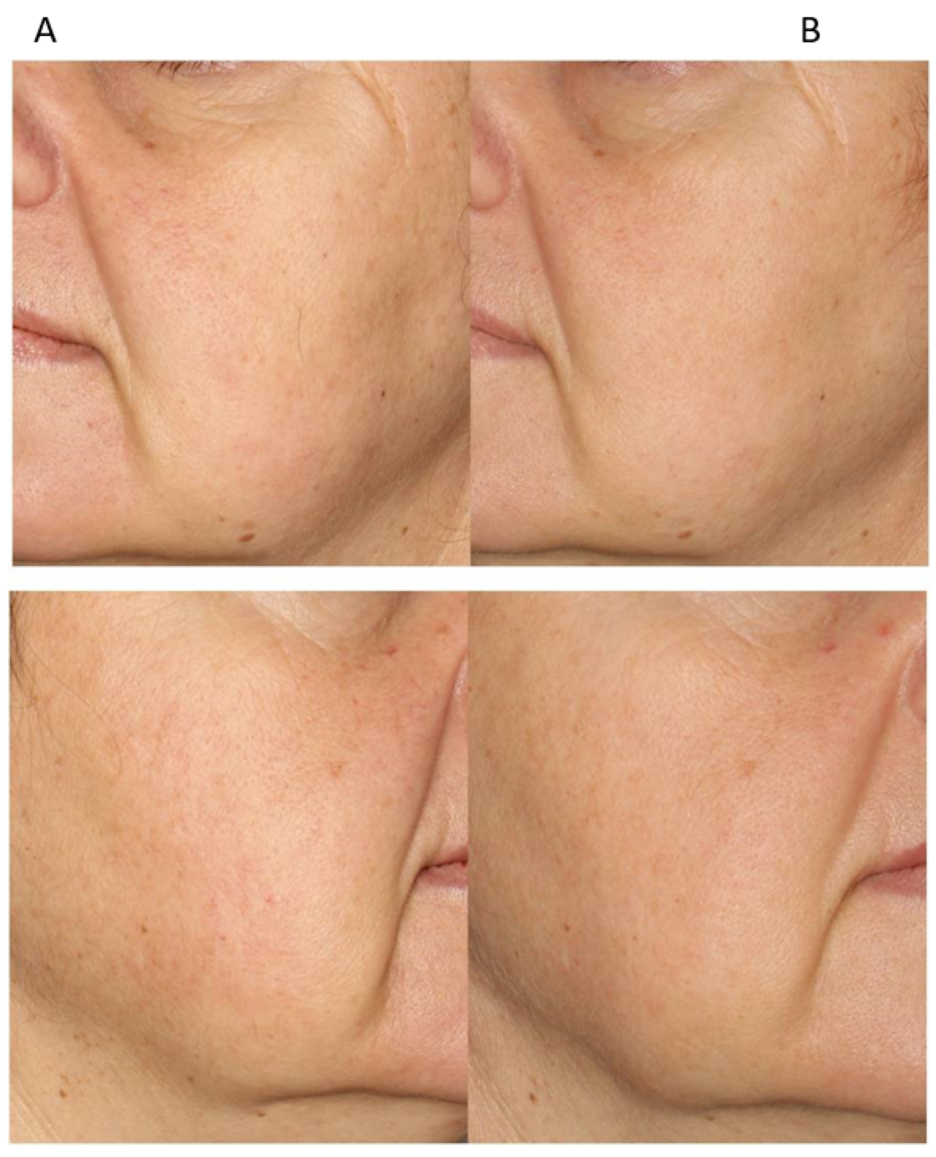 Cosmetics 11 00087 g010