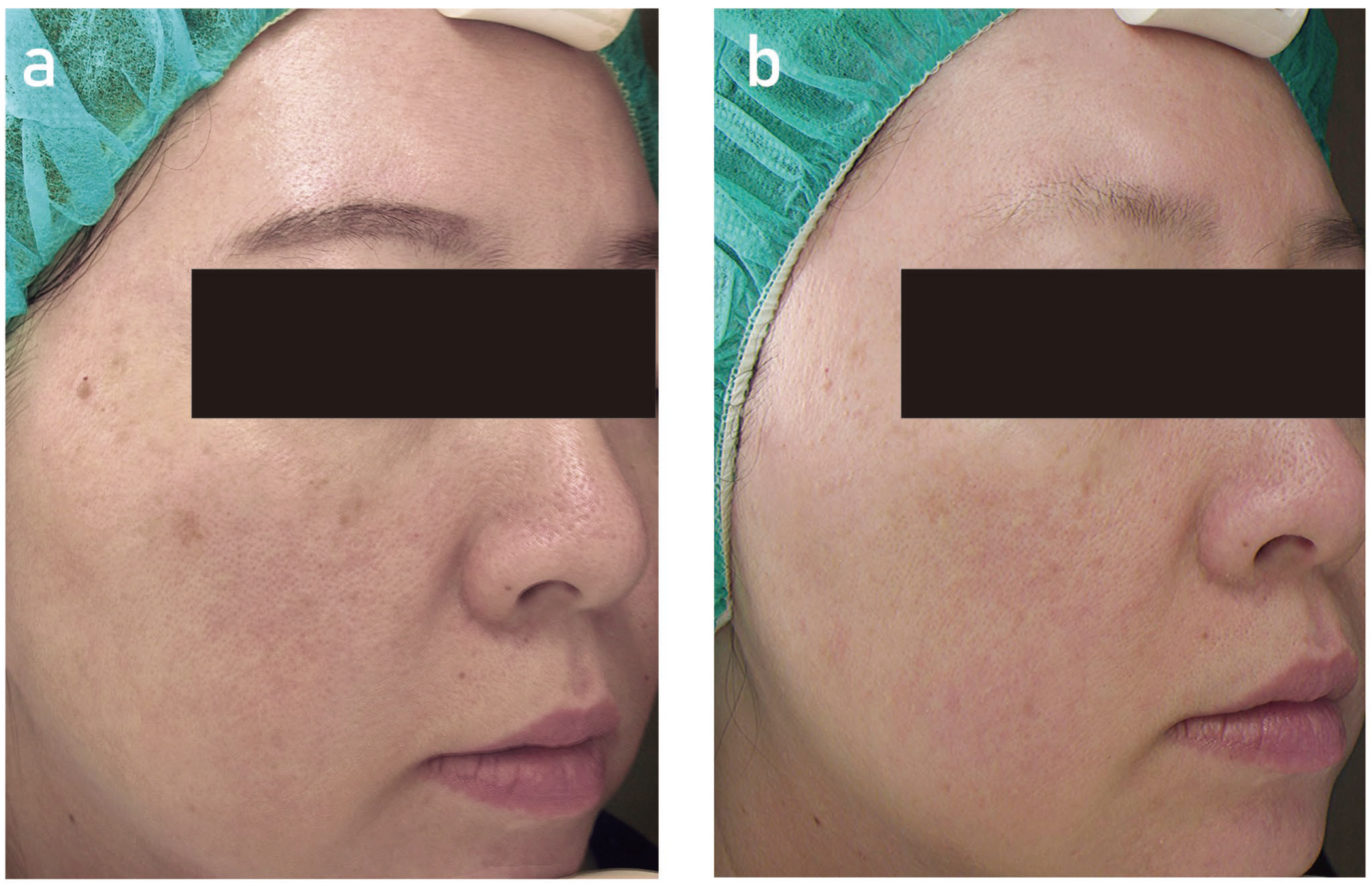 Cosmetics 11 00089 g002