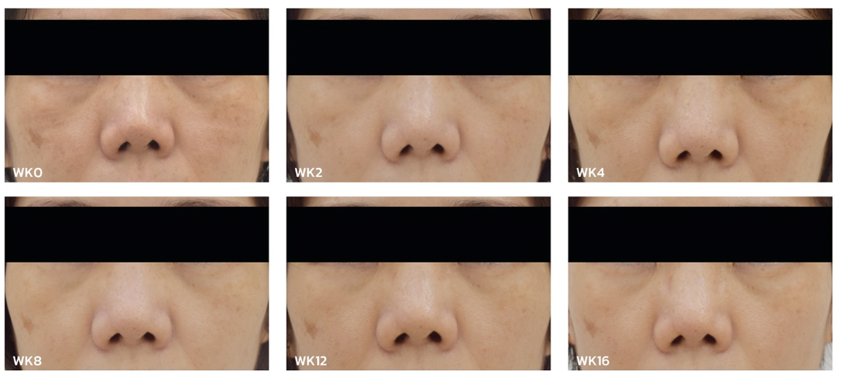 Cosmetics 11 00100 g006