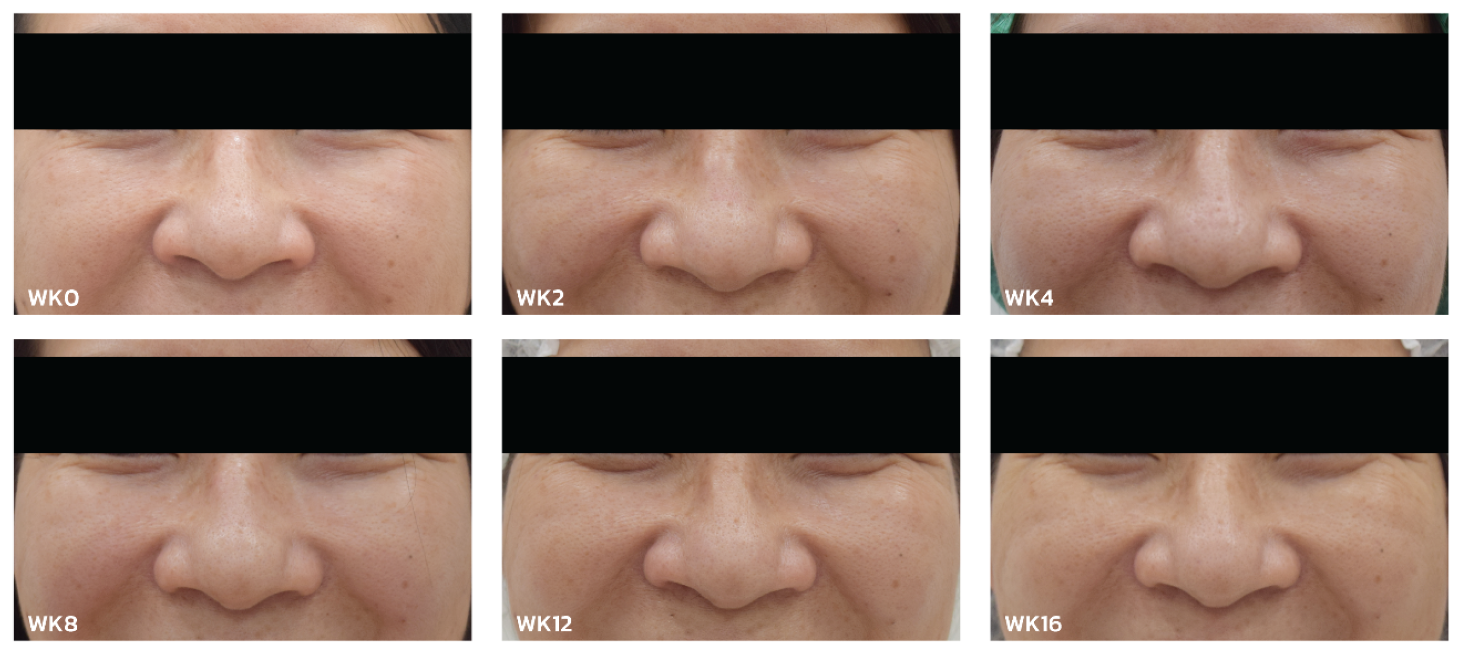 Cosmetics 11 00100 g007