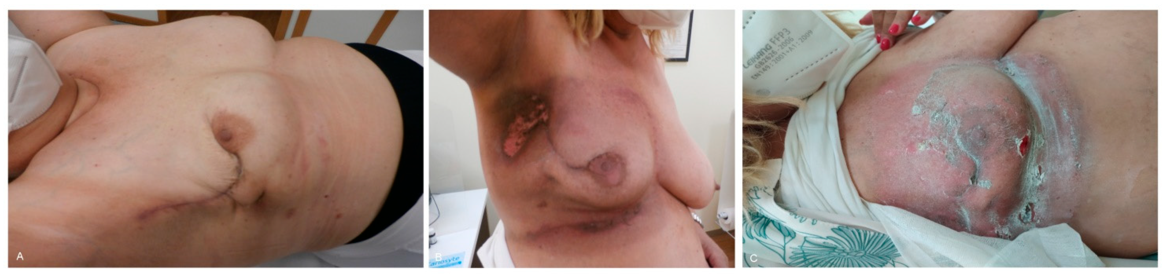 Cosmetics 11 00117 g004