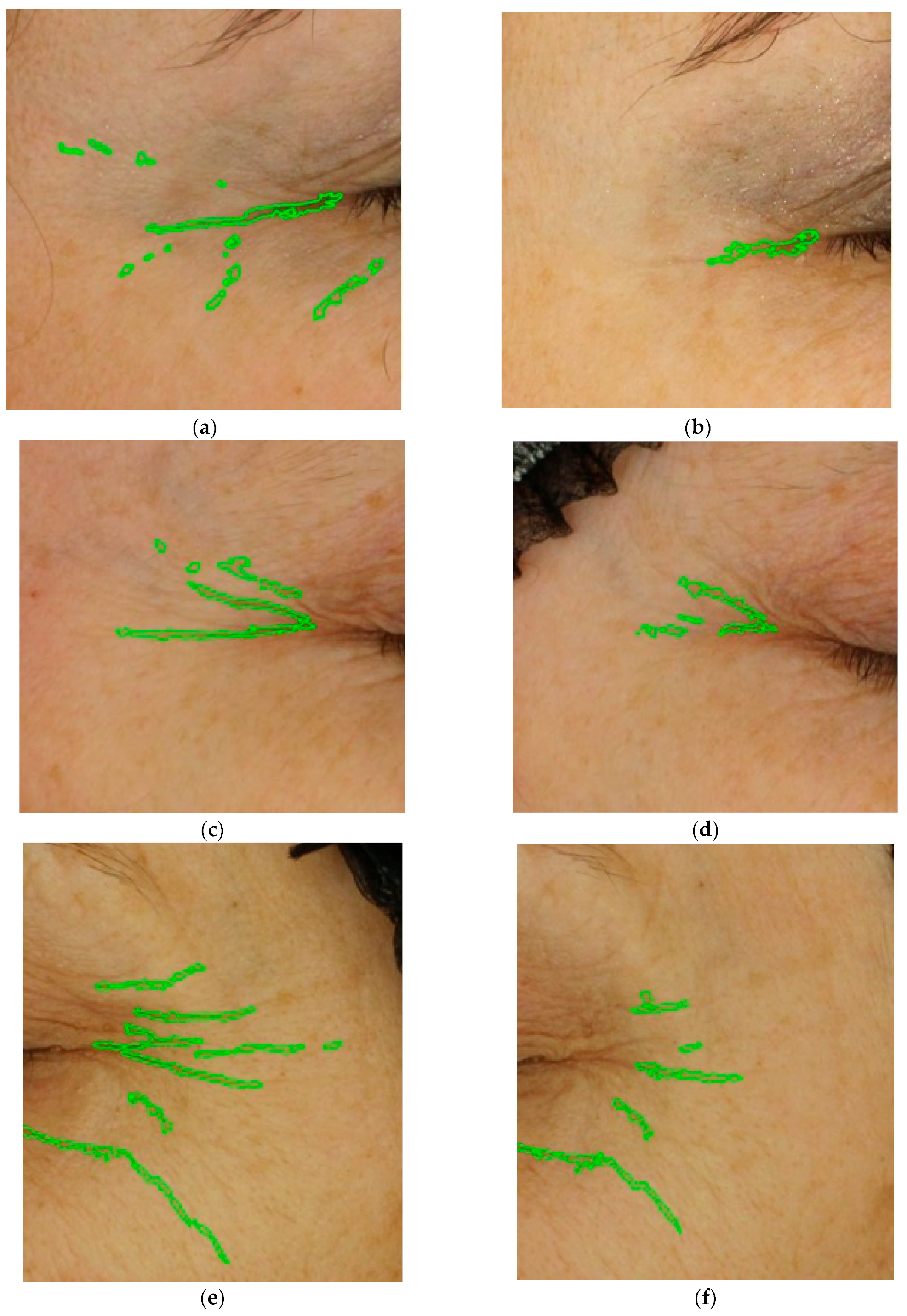 Cosmetics 11 00137 g005