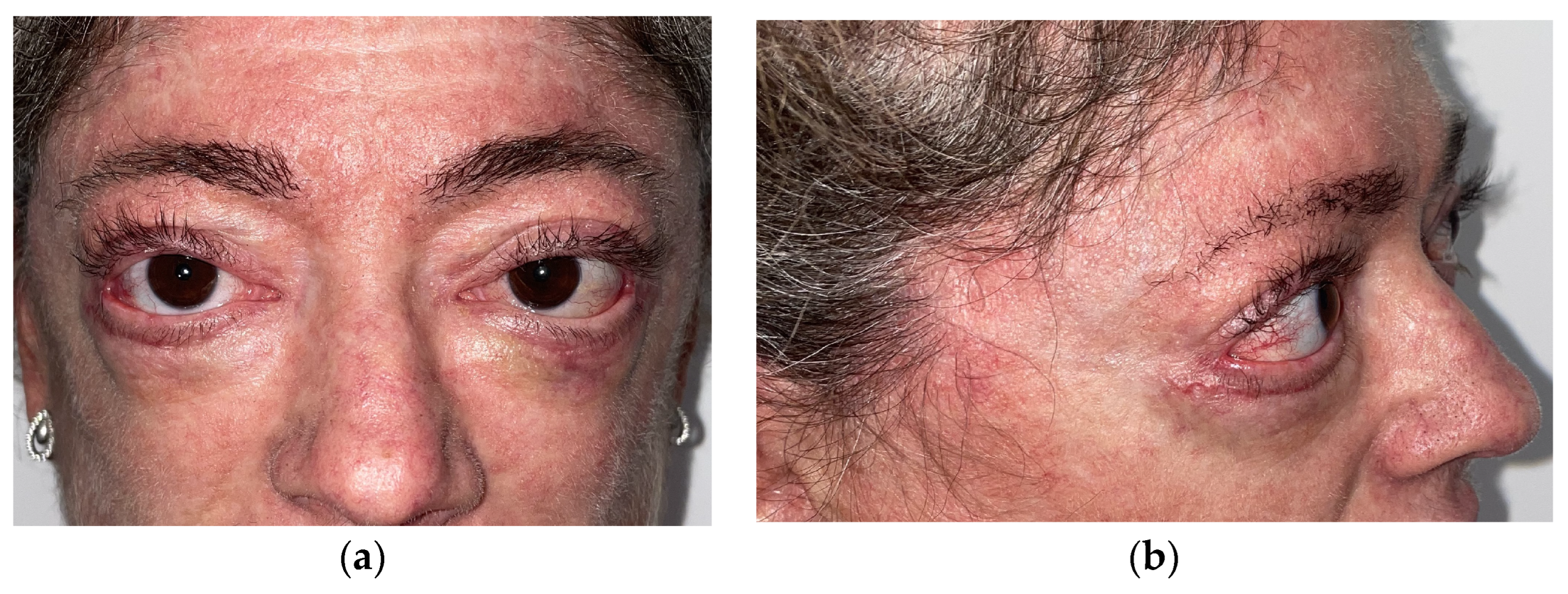 Cosmetics 11 00147 g004