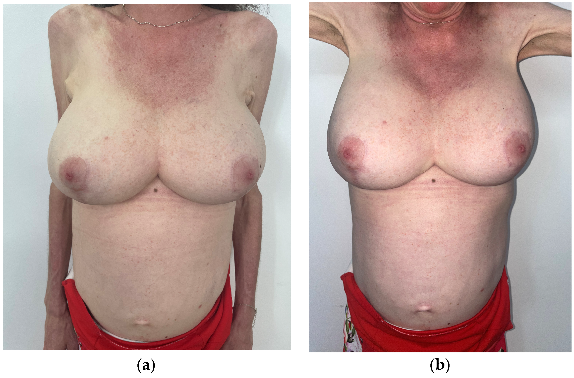 Cosmetics 11 00147 g009