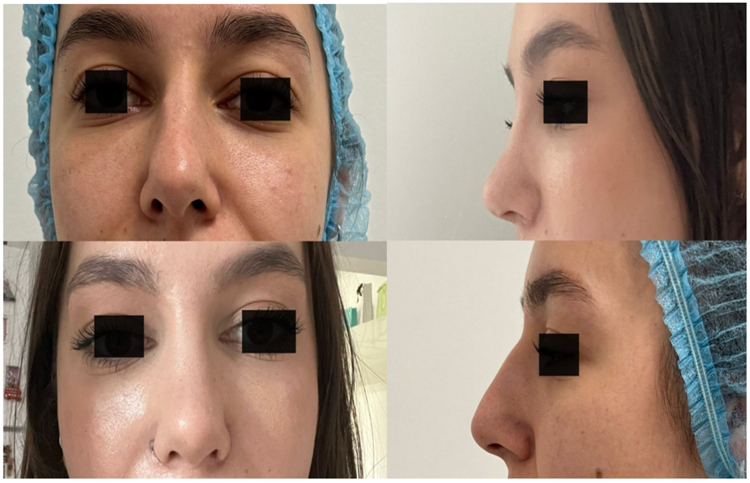 Cosmetics 11 00176 g004