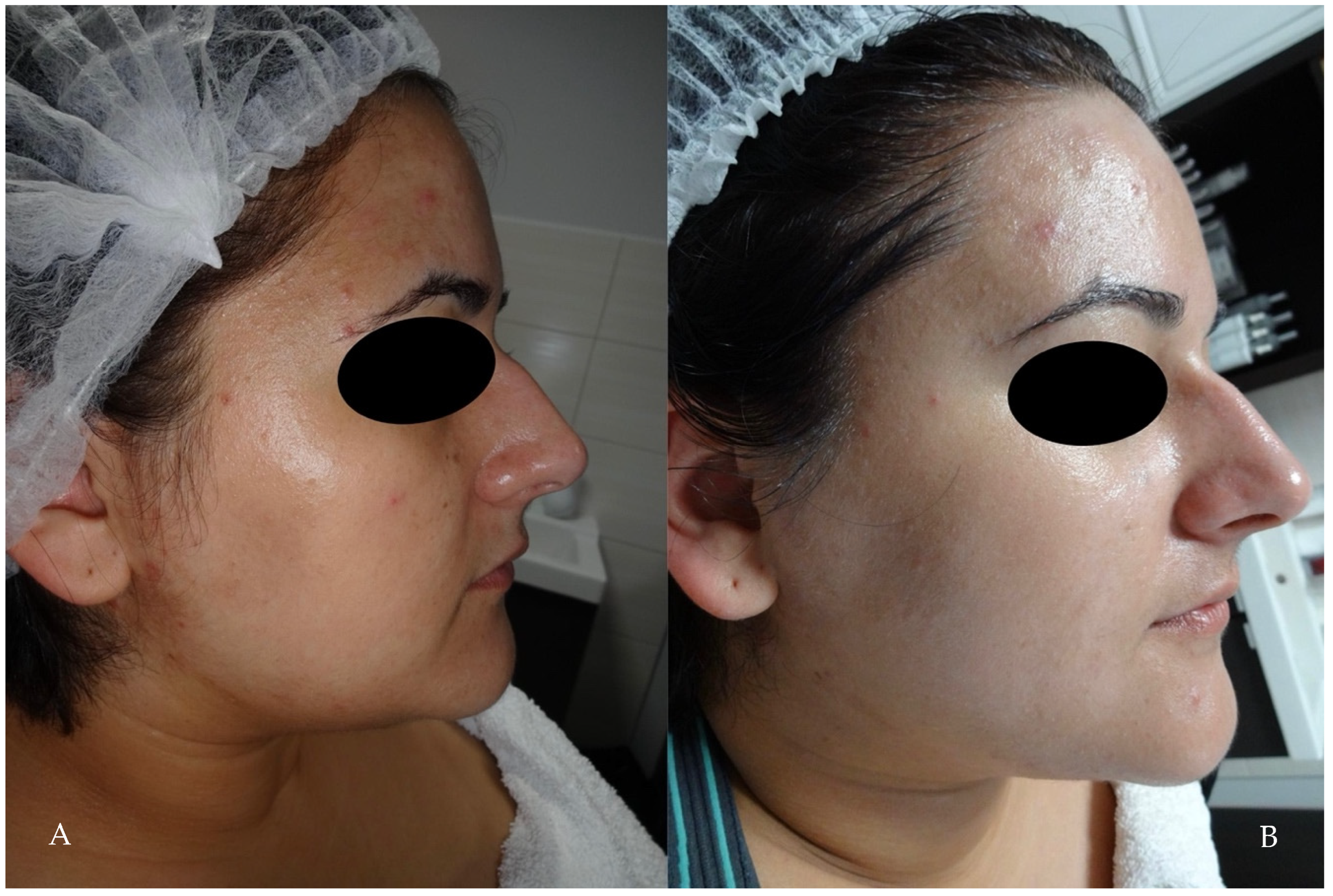 Cosmetics 11 00185 g003