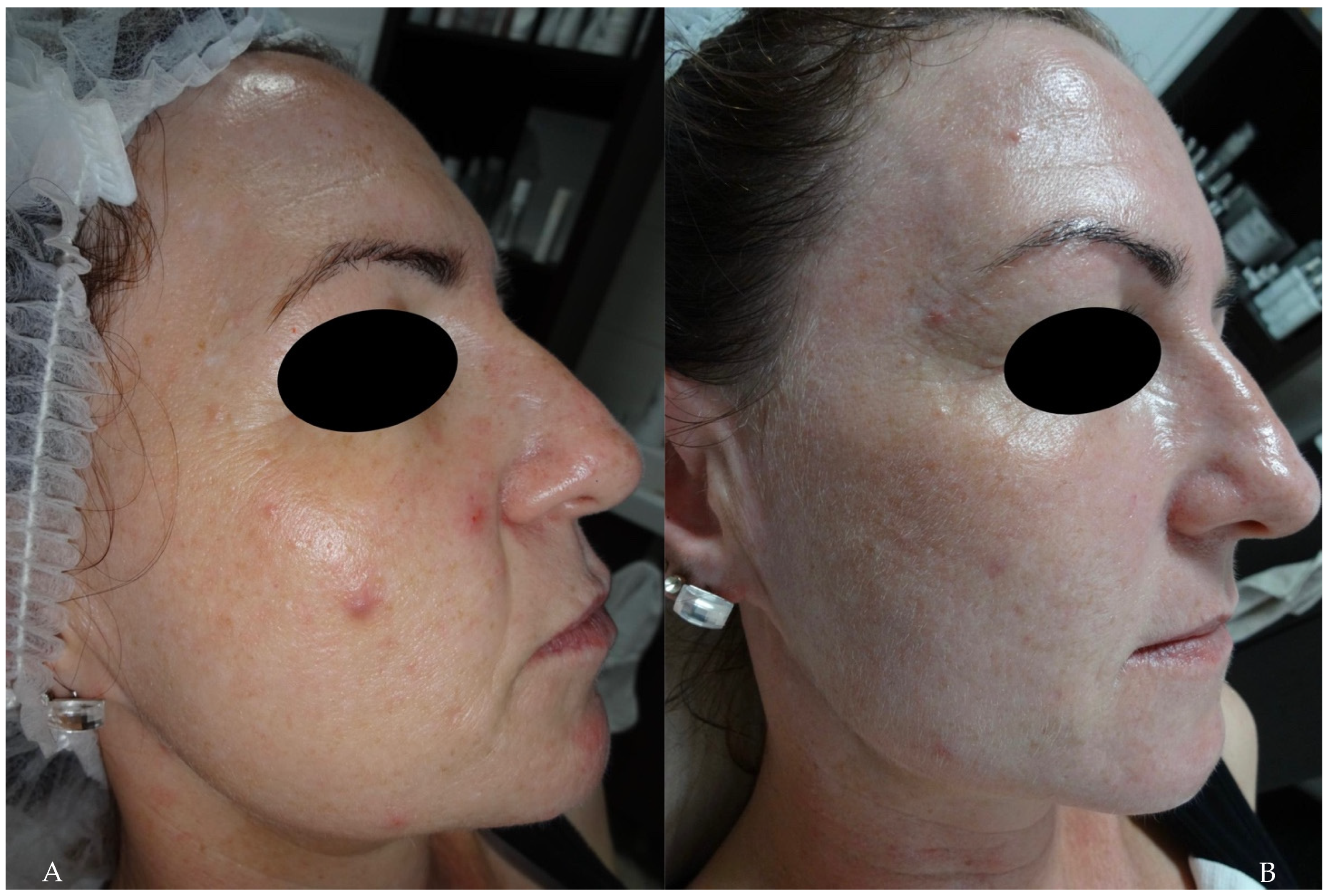 Cosmetics 11 00185 g004