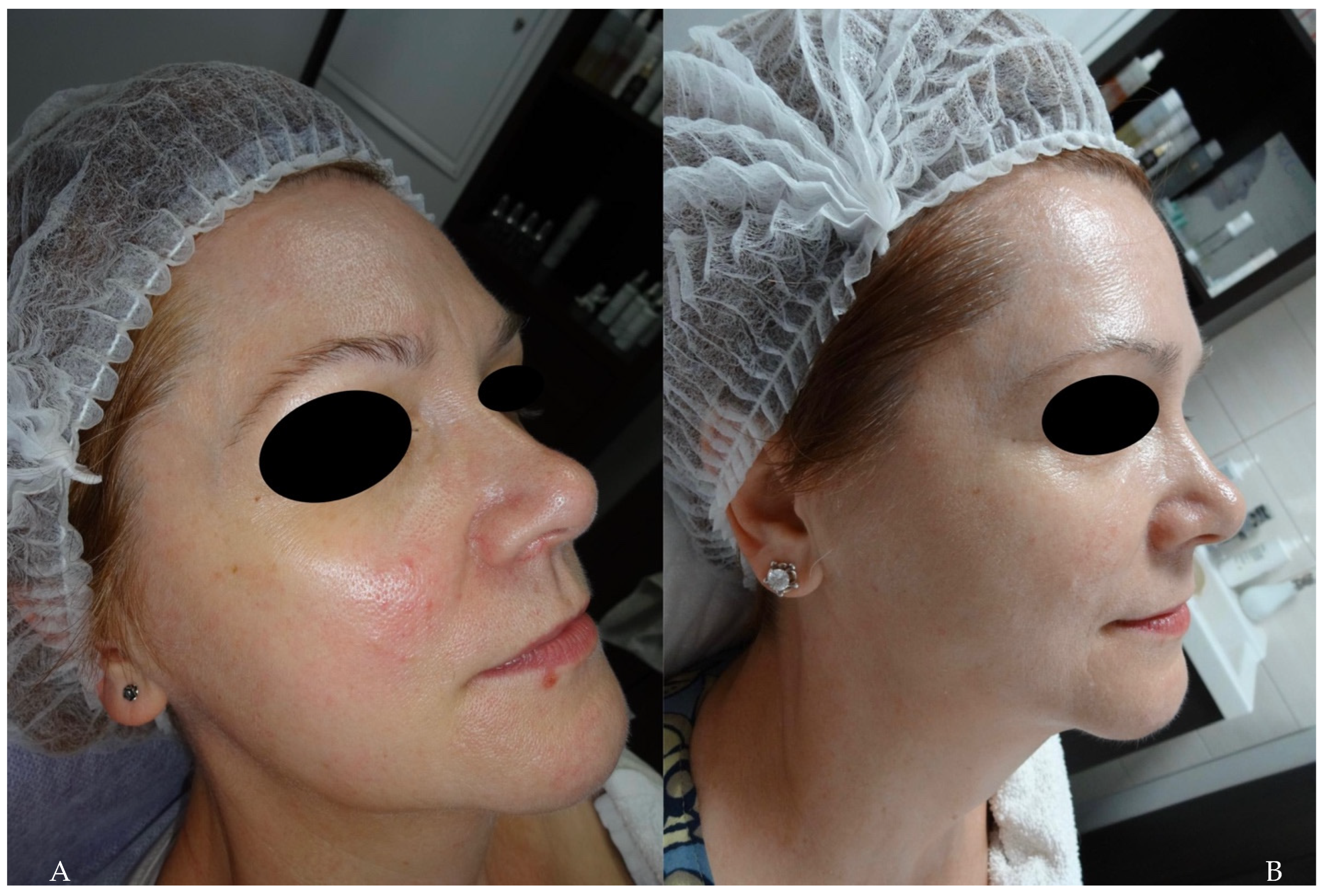 Cosmetics 11 00185 g005