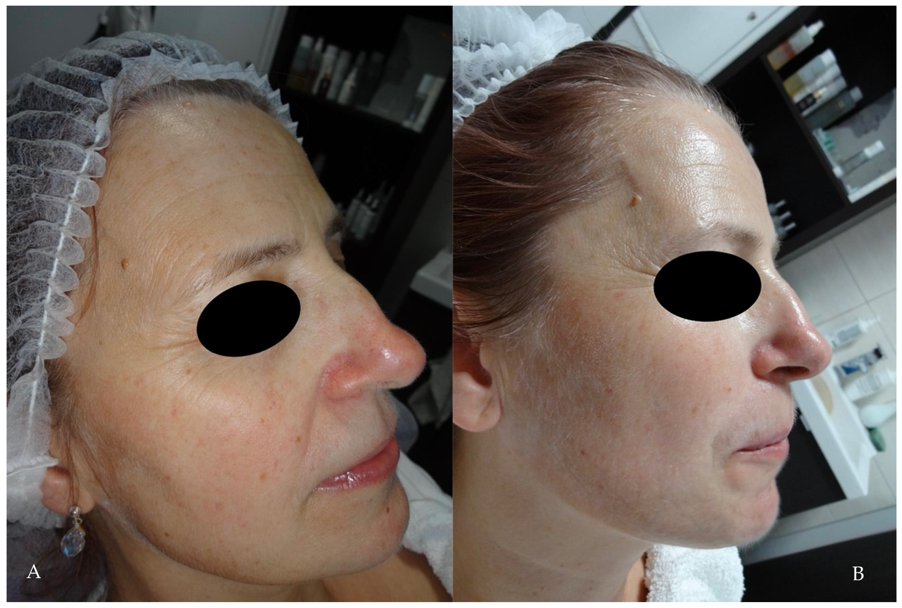 Cosmetics 11 00185 g006