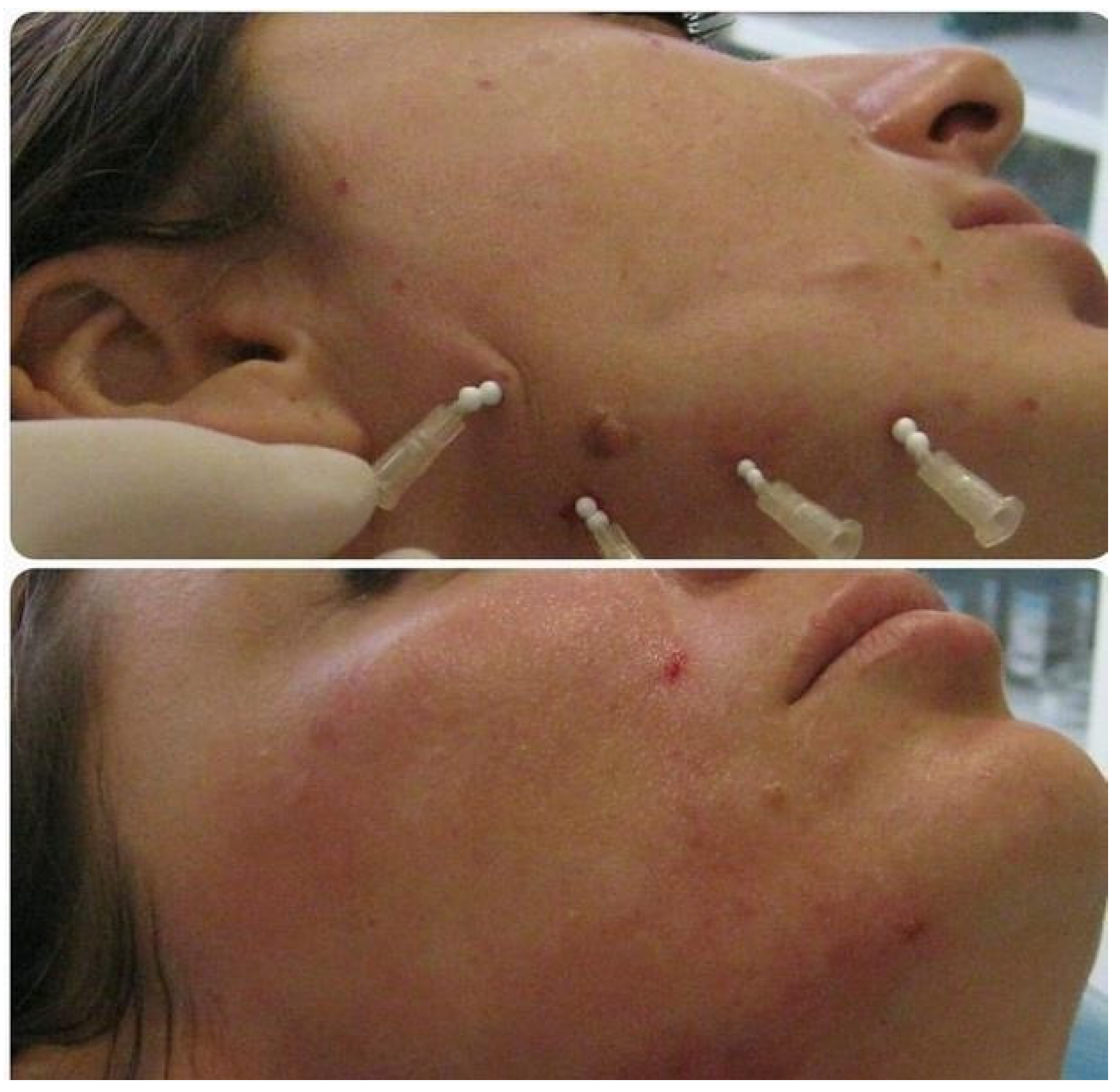 Cosmetics 11 00192 g005