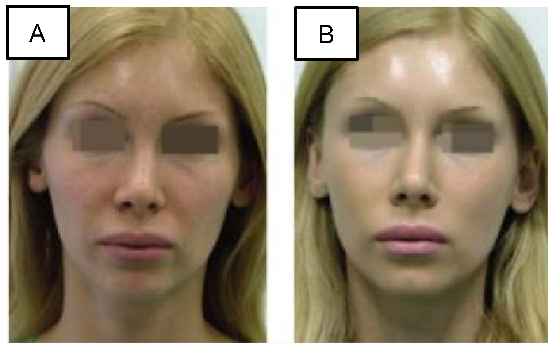 Cosmetics 11 00192 g006