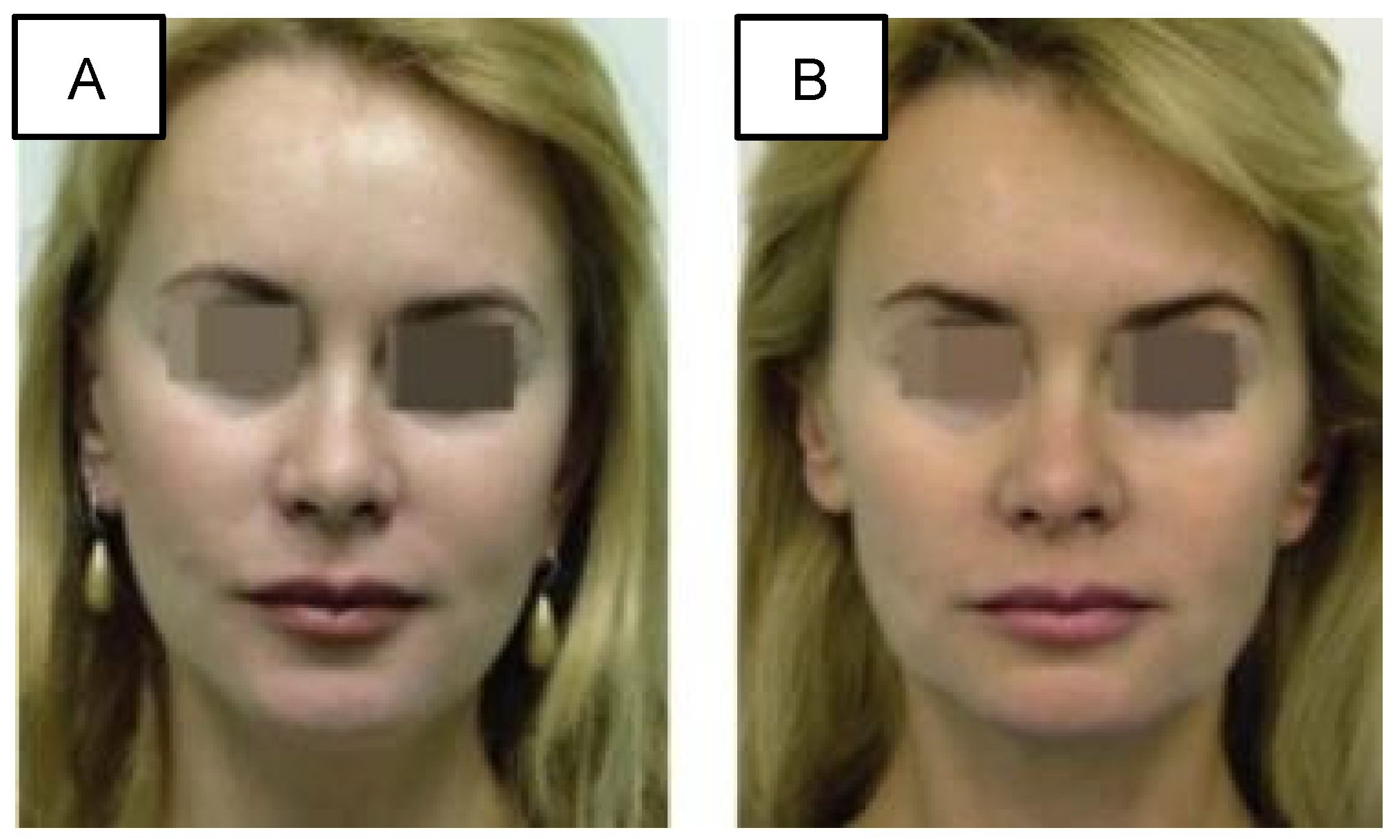 Cosmetics 11 00192 g008