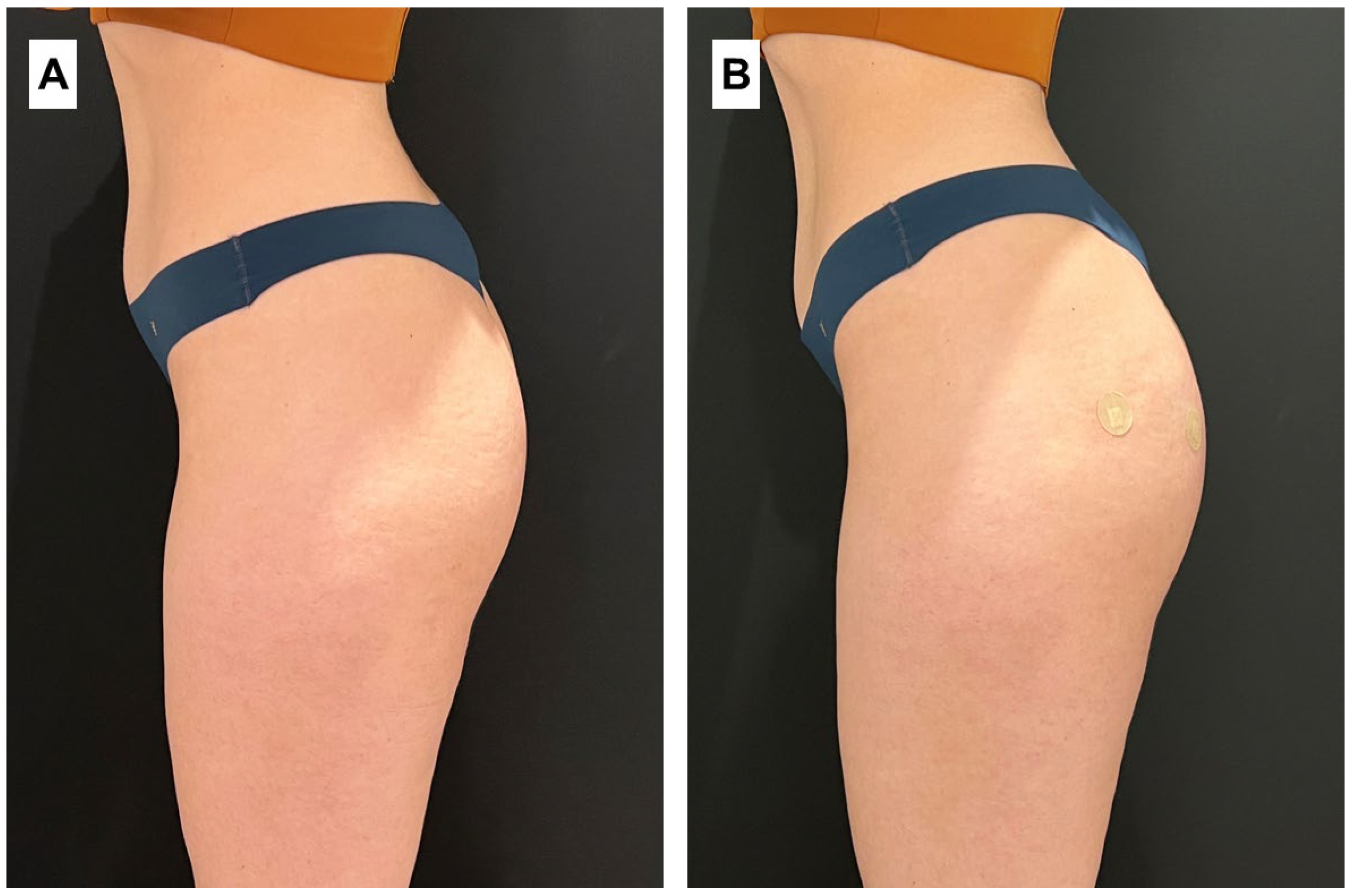 Cosmetics 11 00194 g003