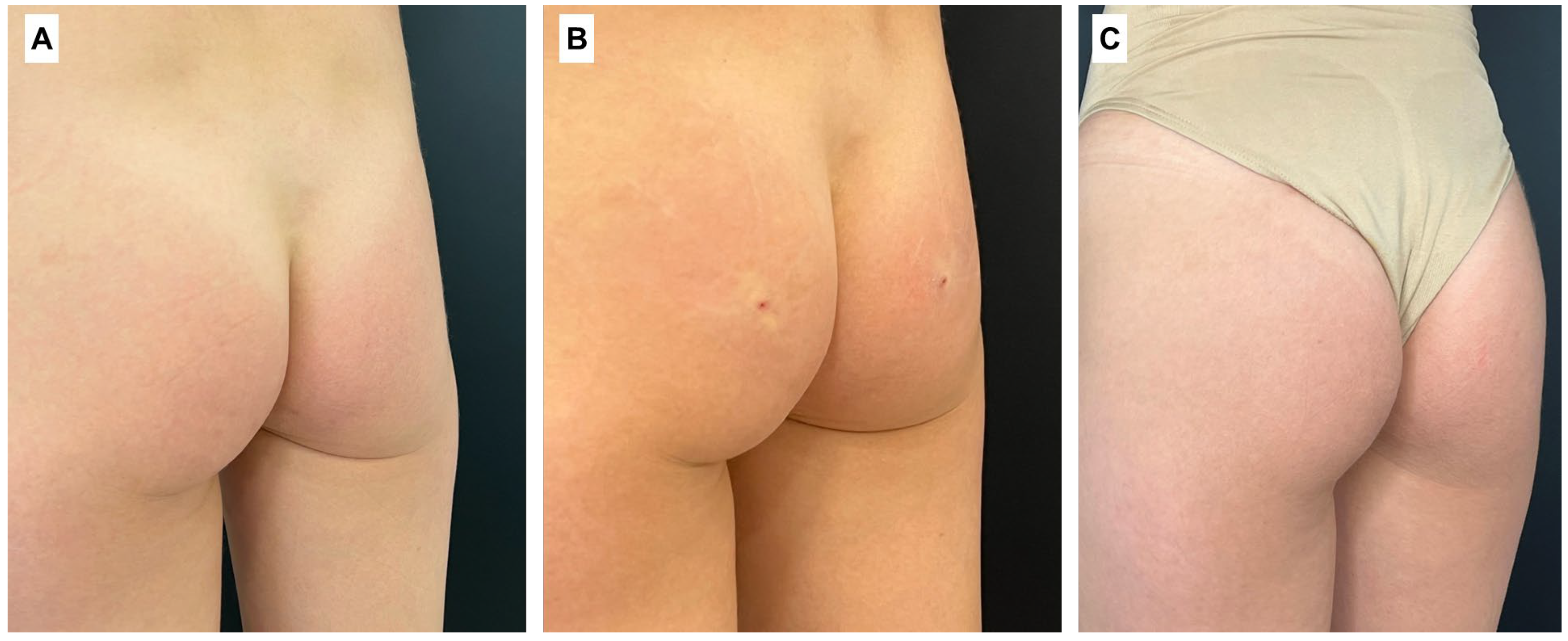 Cosmetics 11 00194 g004