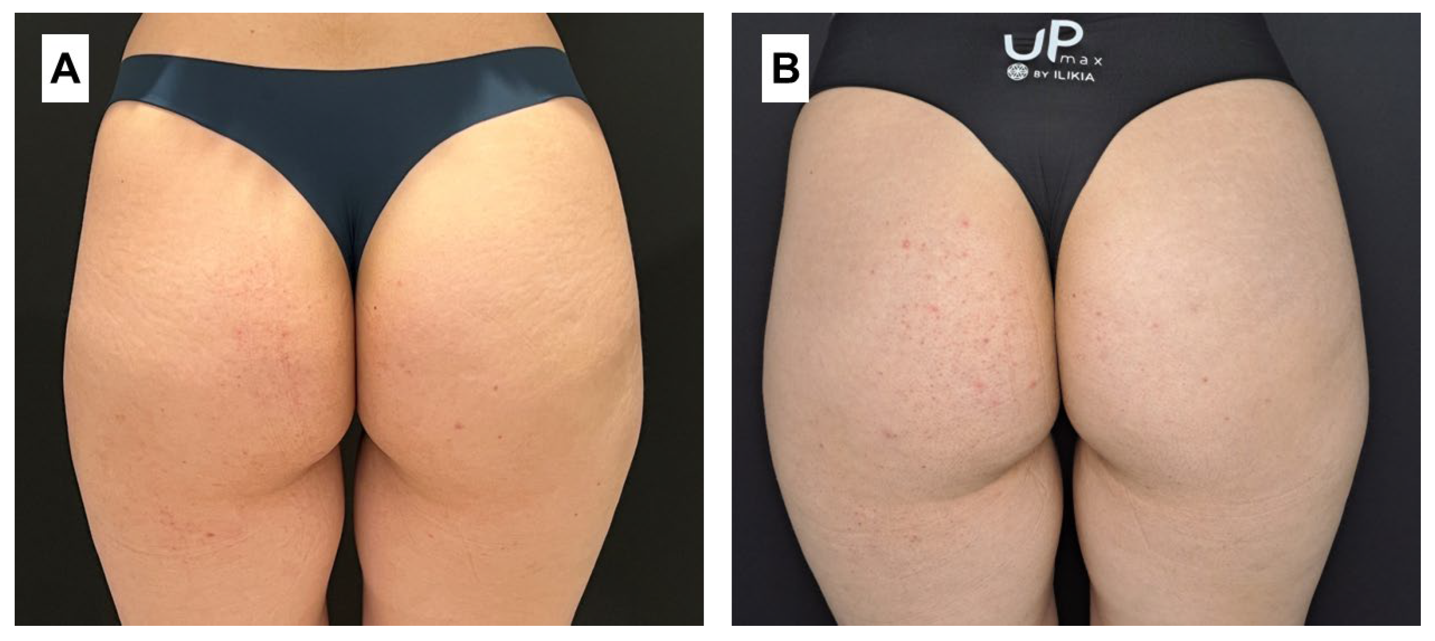 Cosmetics 11 00194 g005