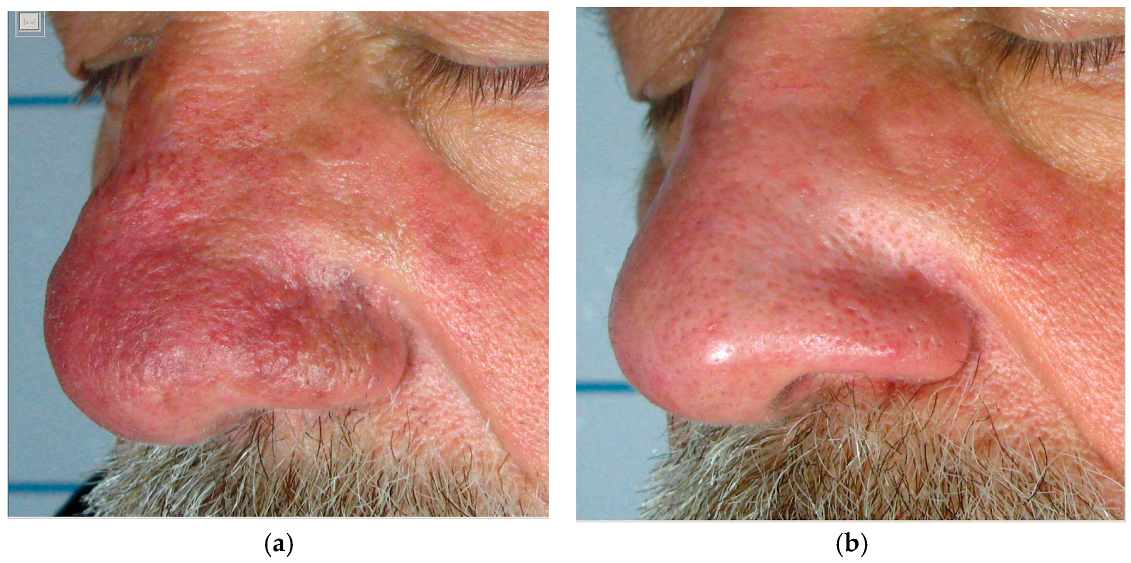 Cosmetics 11 00221 g009