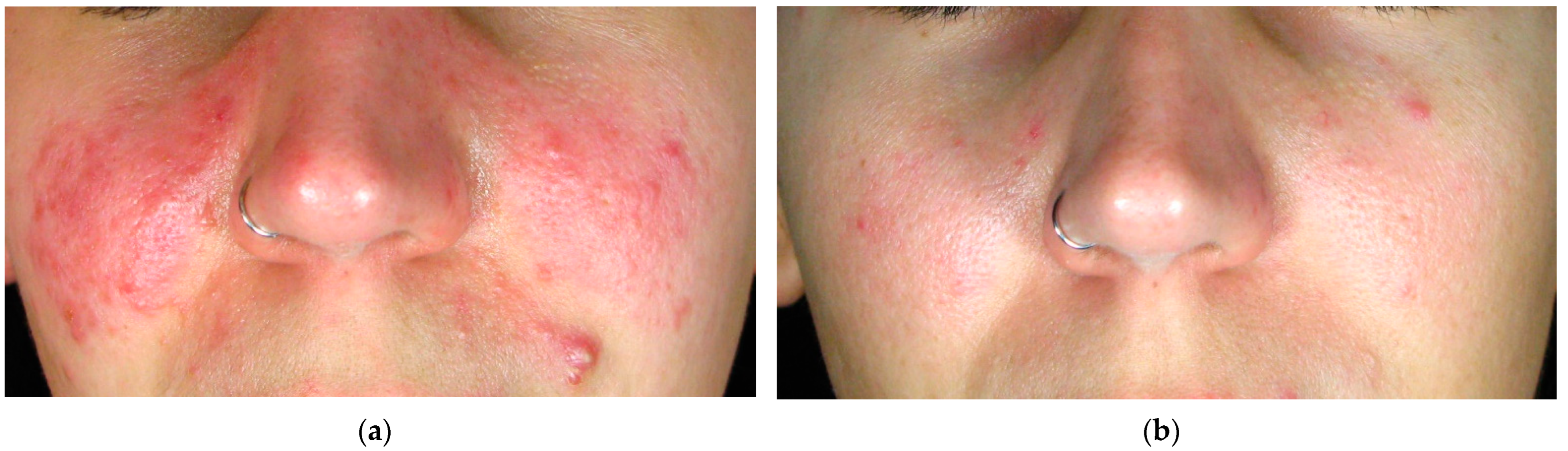 Cosmetics 11 00227 g001